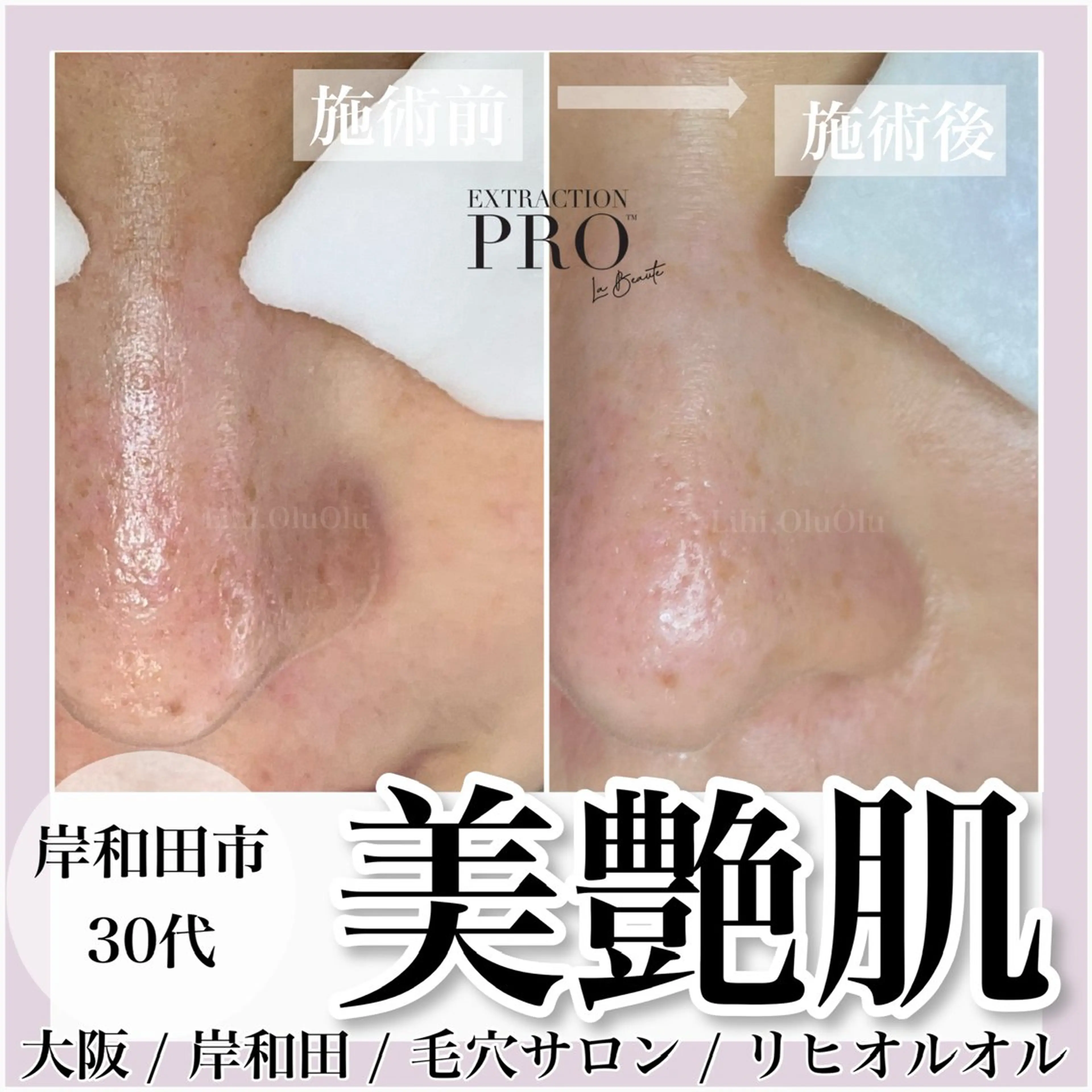 毛穴汚れ改善専門店/ 岸和田/リヒオルオルのエステ・リラクイメージ