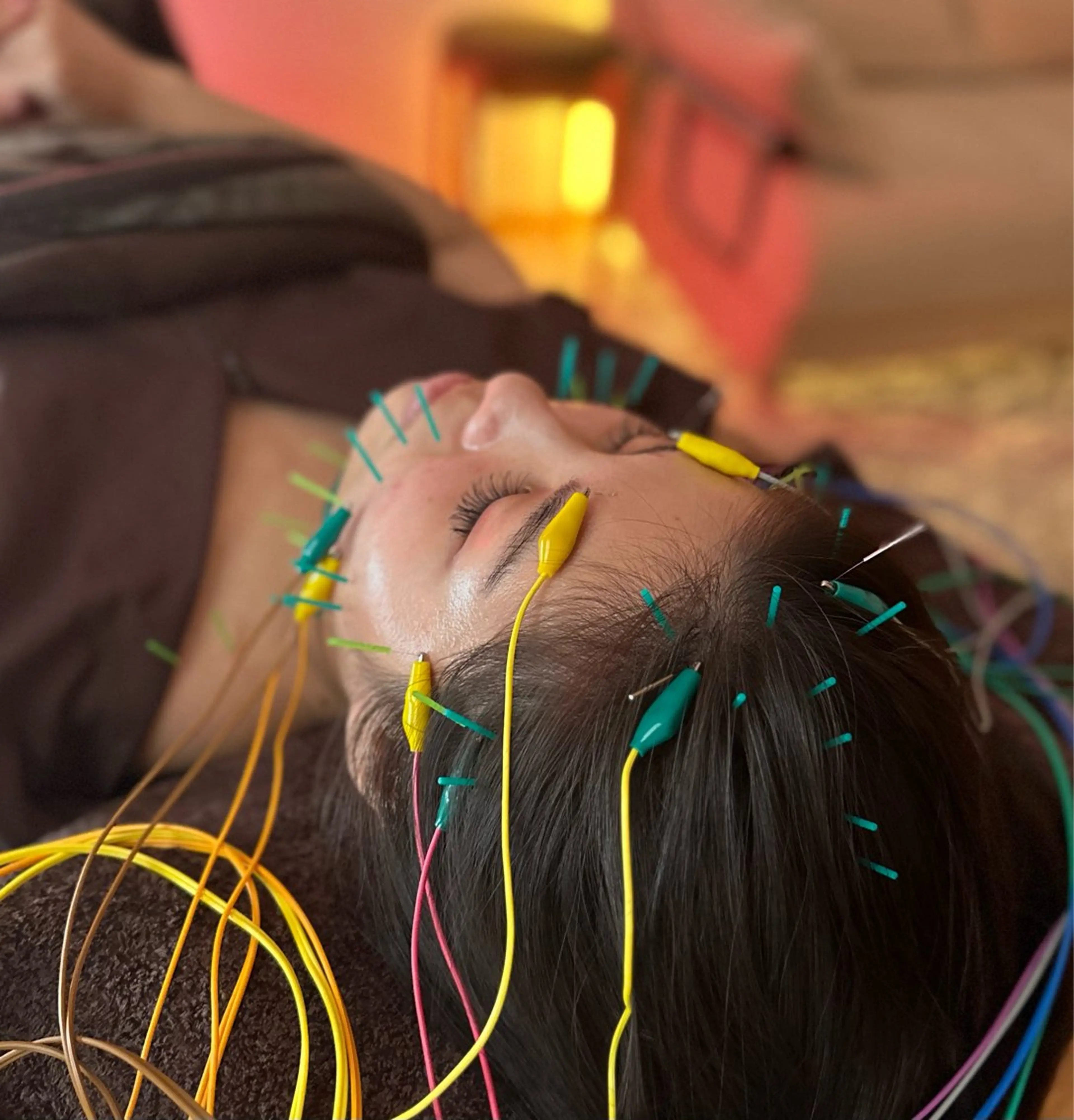 大満足♥️頭/お顔/首肩/デコルテ/腕/足（美容鍼＆仰向け全身）鍼60本🪡32ヶ所電流⚡️【まるで8頭身コース】60分の写真