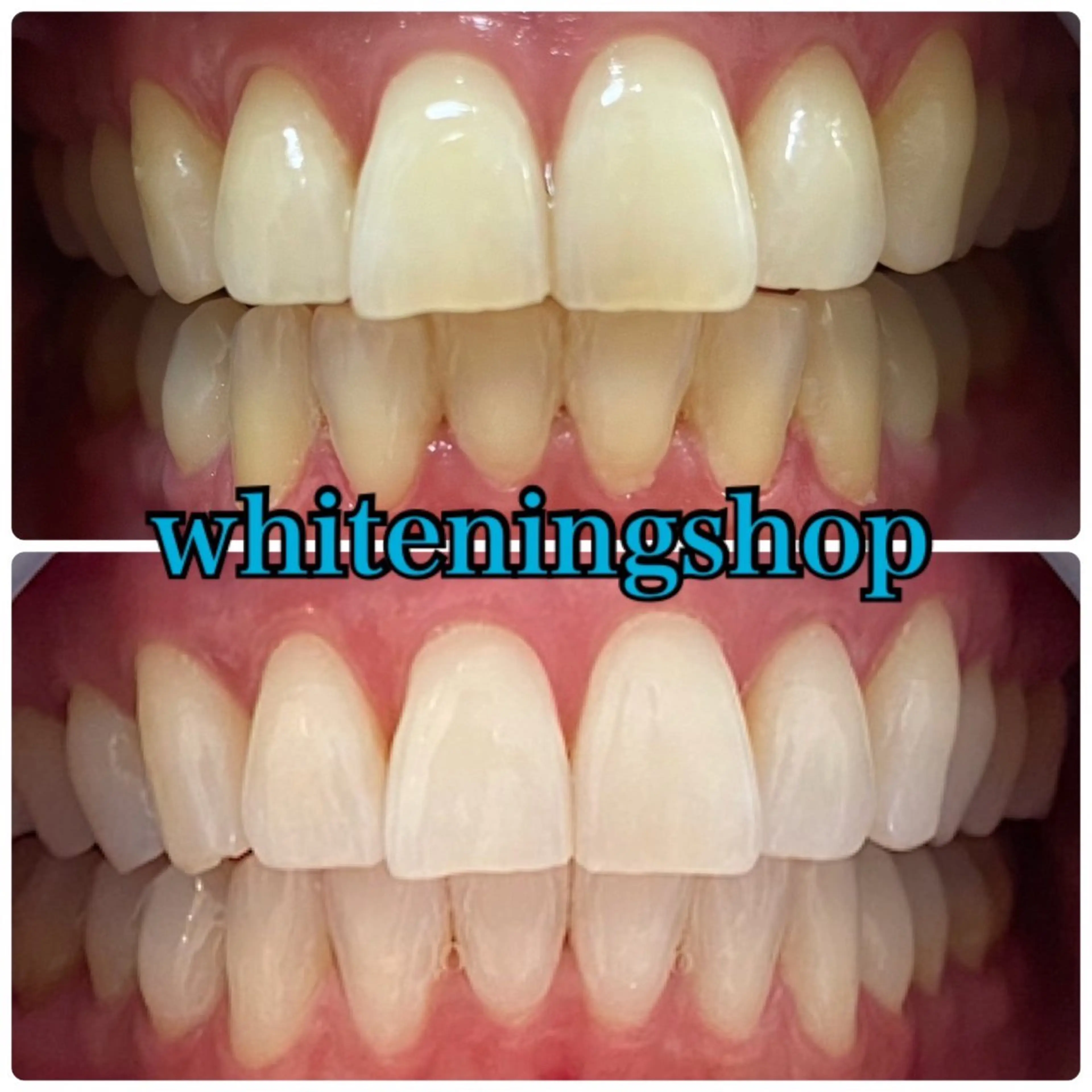 エステ リラク ホワイトニング ショップ吉祥寺店のエステ・リラクイメージ