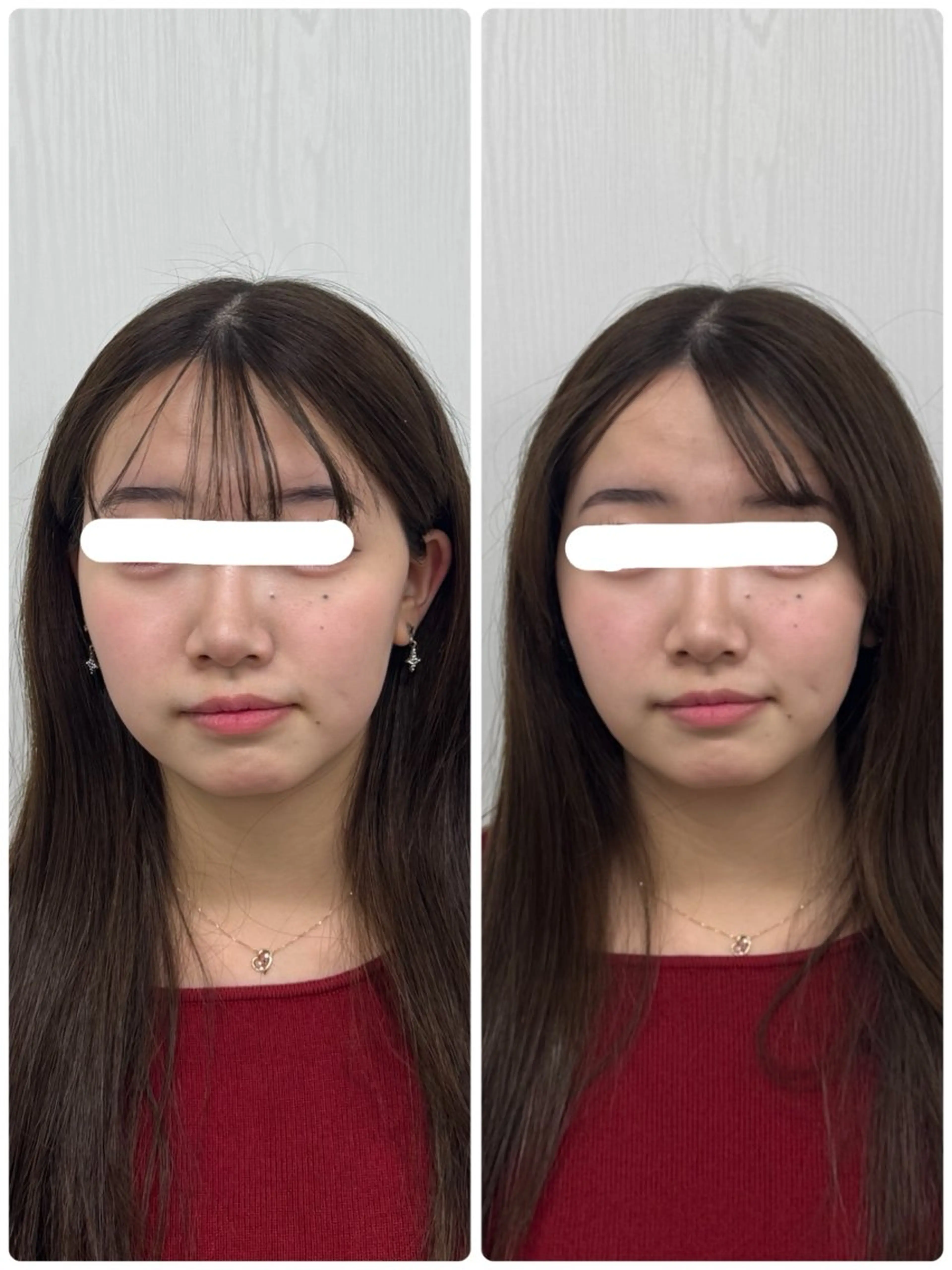 エステ リラク 美容鍼×小顔矯正 ×美容整体　浜川泰仁のエステ・リラクイメージ