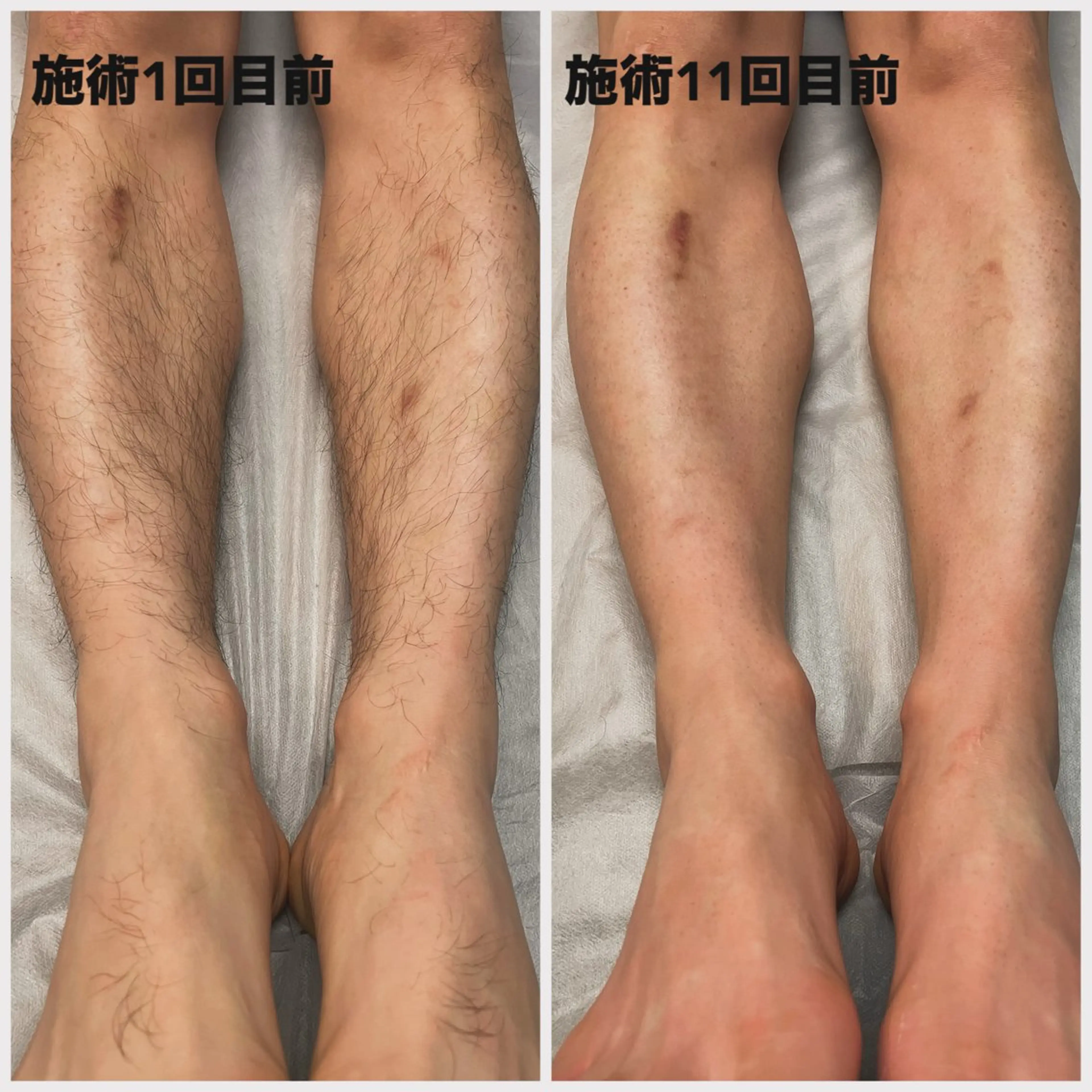 メンズ Esthetic Salon ECLIA所属・ECLIA 中田のエステ・リラクイメージ