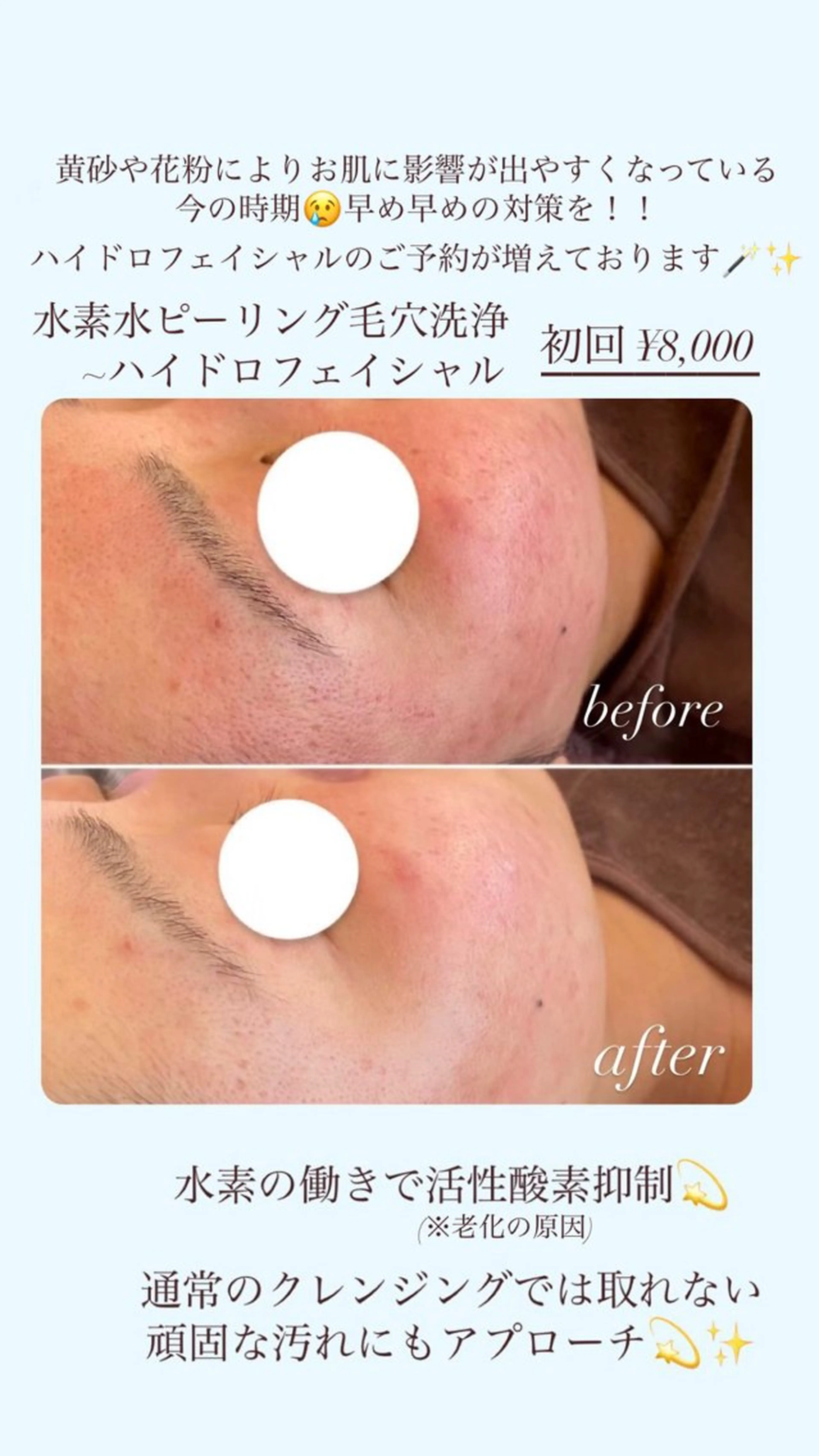 【頭痛、睡眠改善】 salon RUUのエステ・リラクイメージ