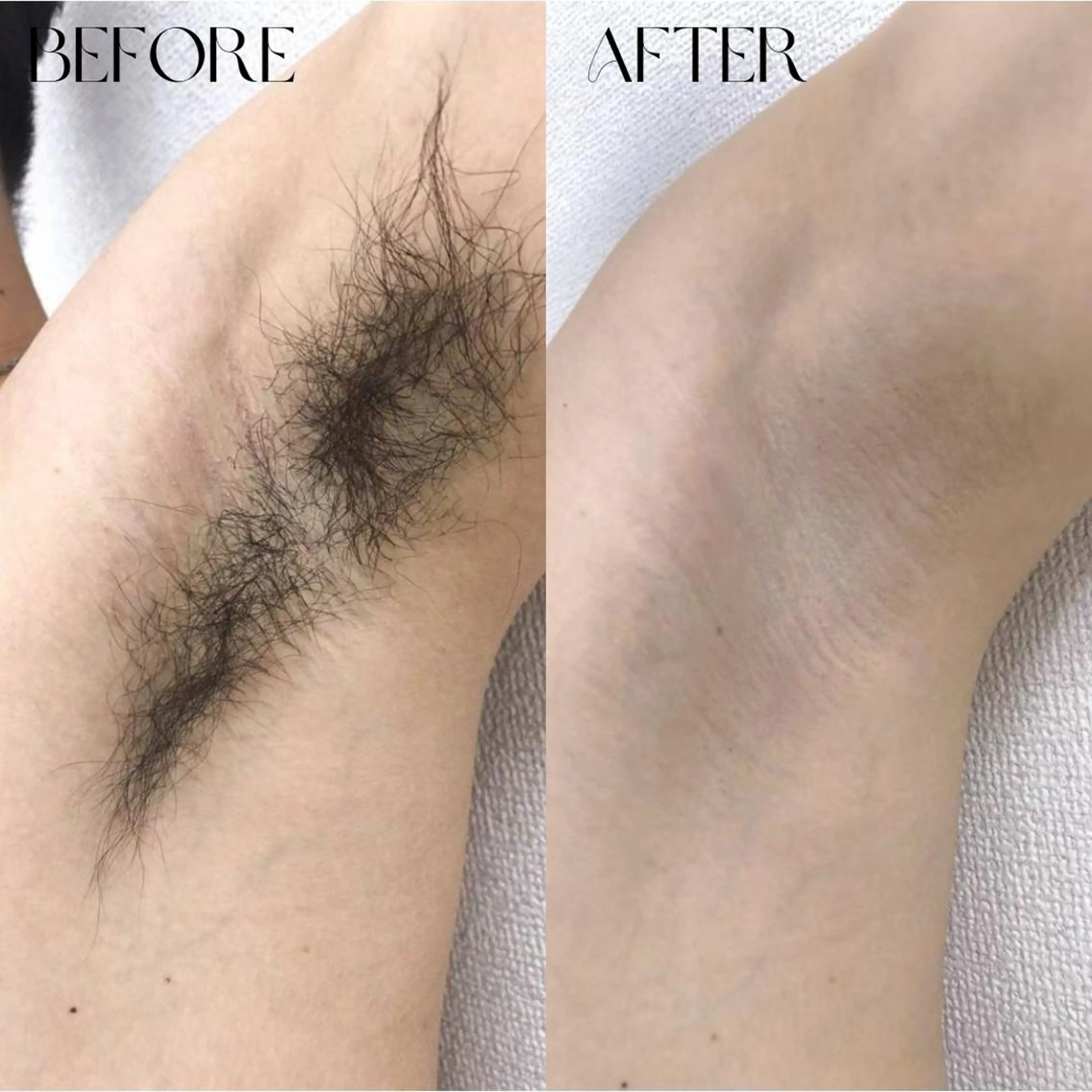 脱毛 B-st. 下北沢のエステ・リラクイメージ