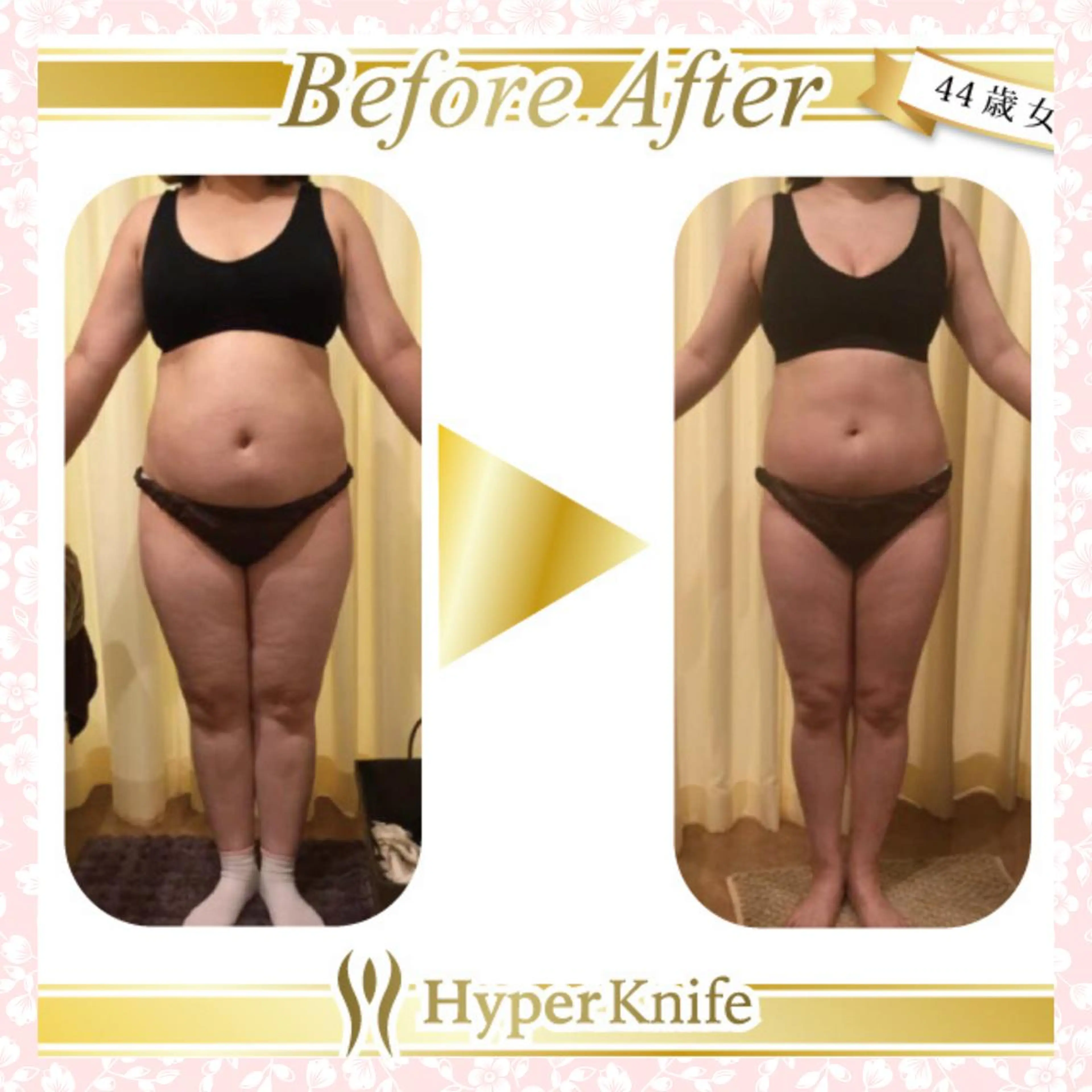 エステサロン　Sブランペタル所属・三沢市エステサロン Sブランペタルのエステ・リラクイメージ