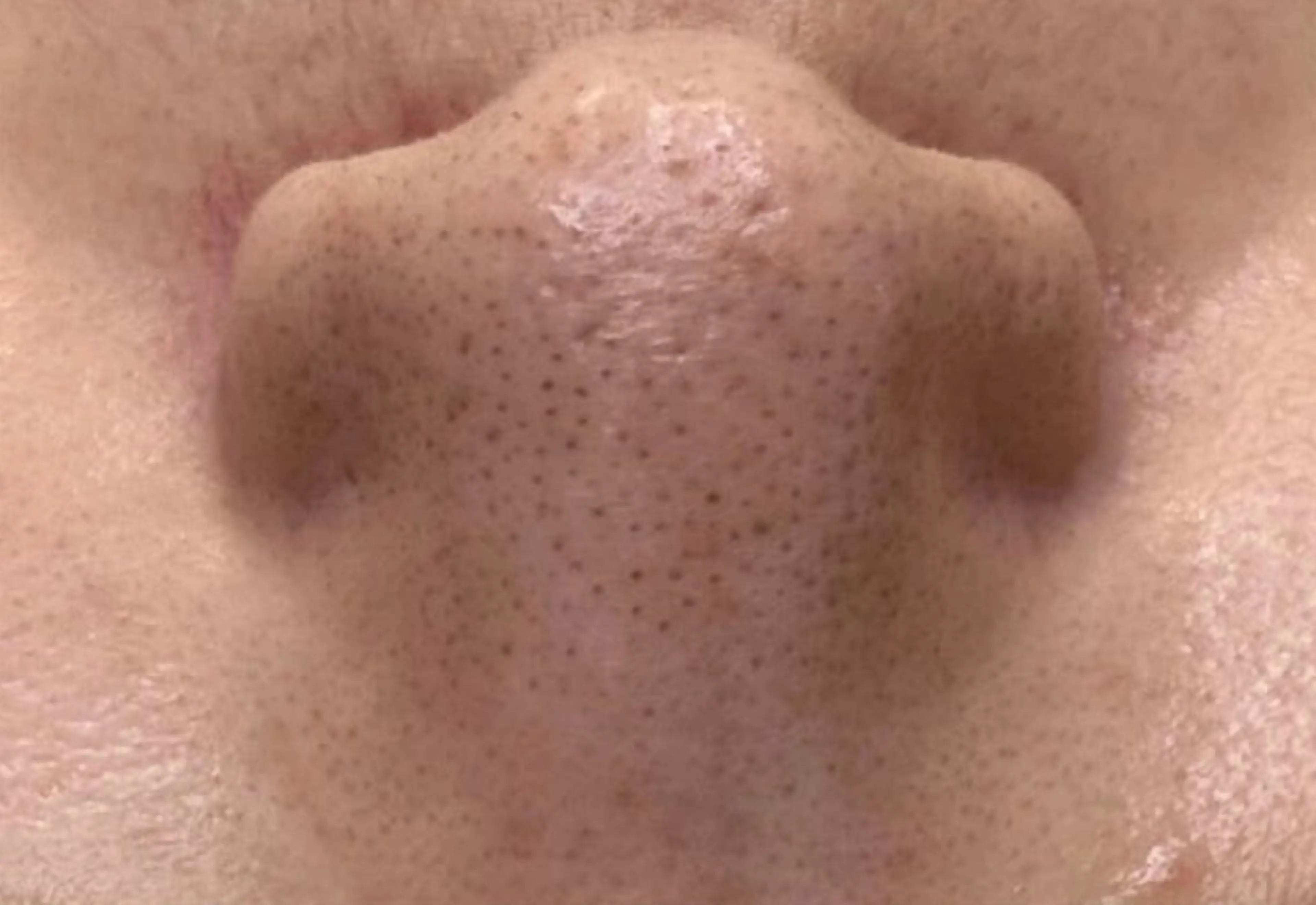 東京ビューティー 五反田店　nanaのエステ・リラクイメージ