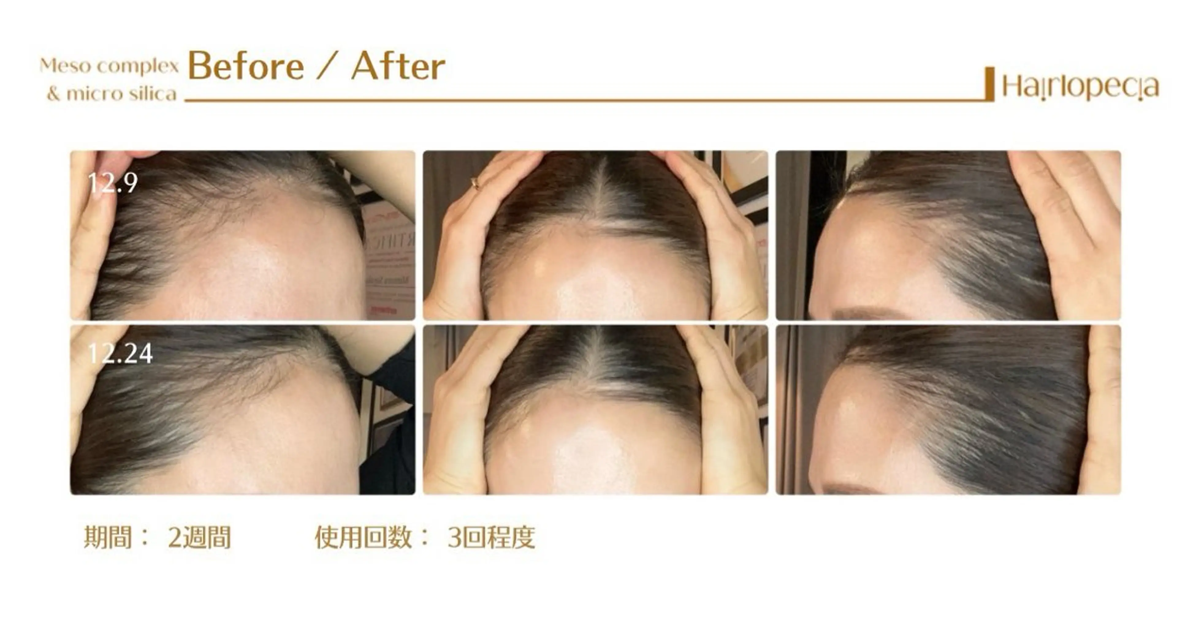 ホワイトニングサロン EARTH目黒店のその他イメージ