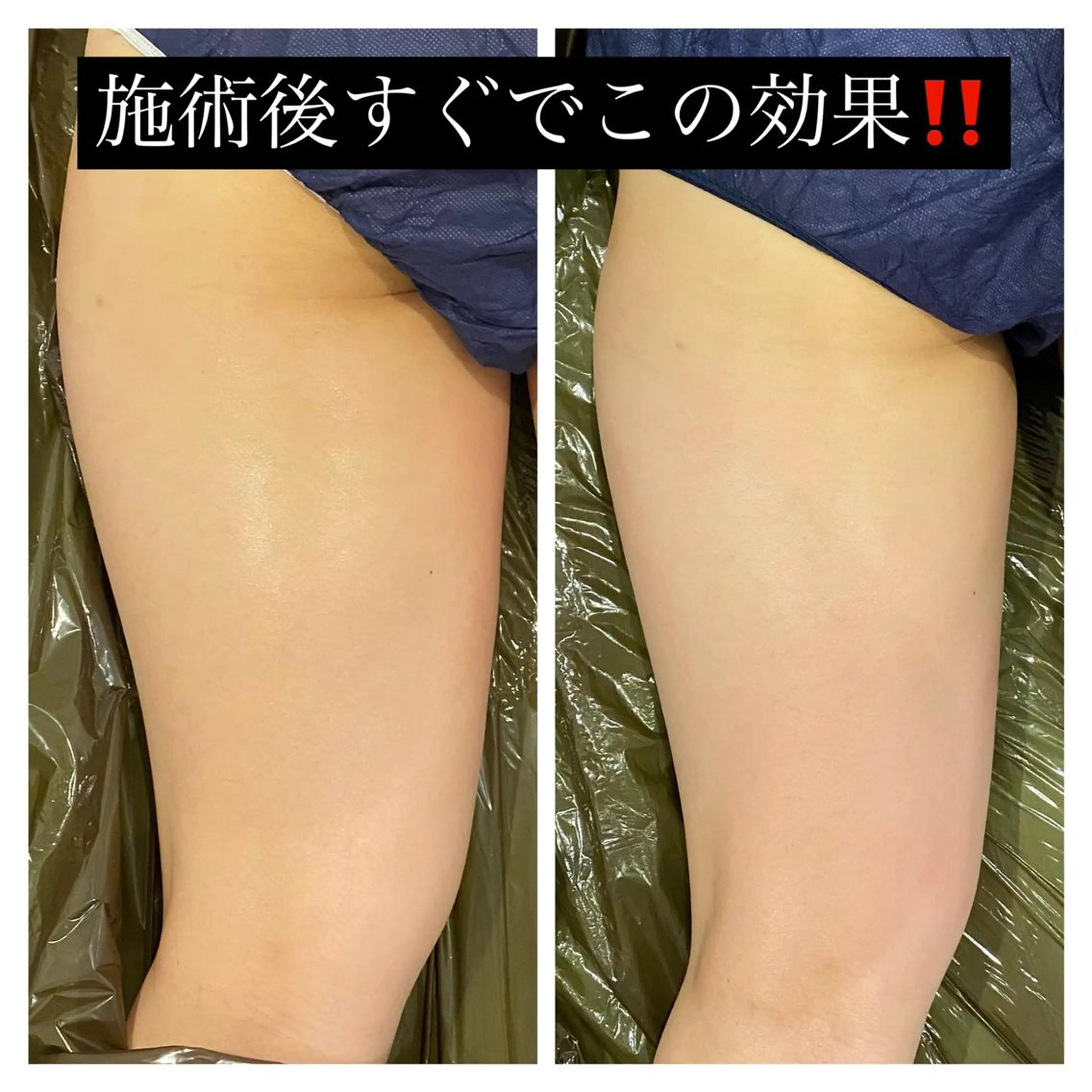 エステ リラク 通うほど変わる本格 エステ心斎橋REVIのエステ・リラクイメージ