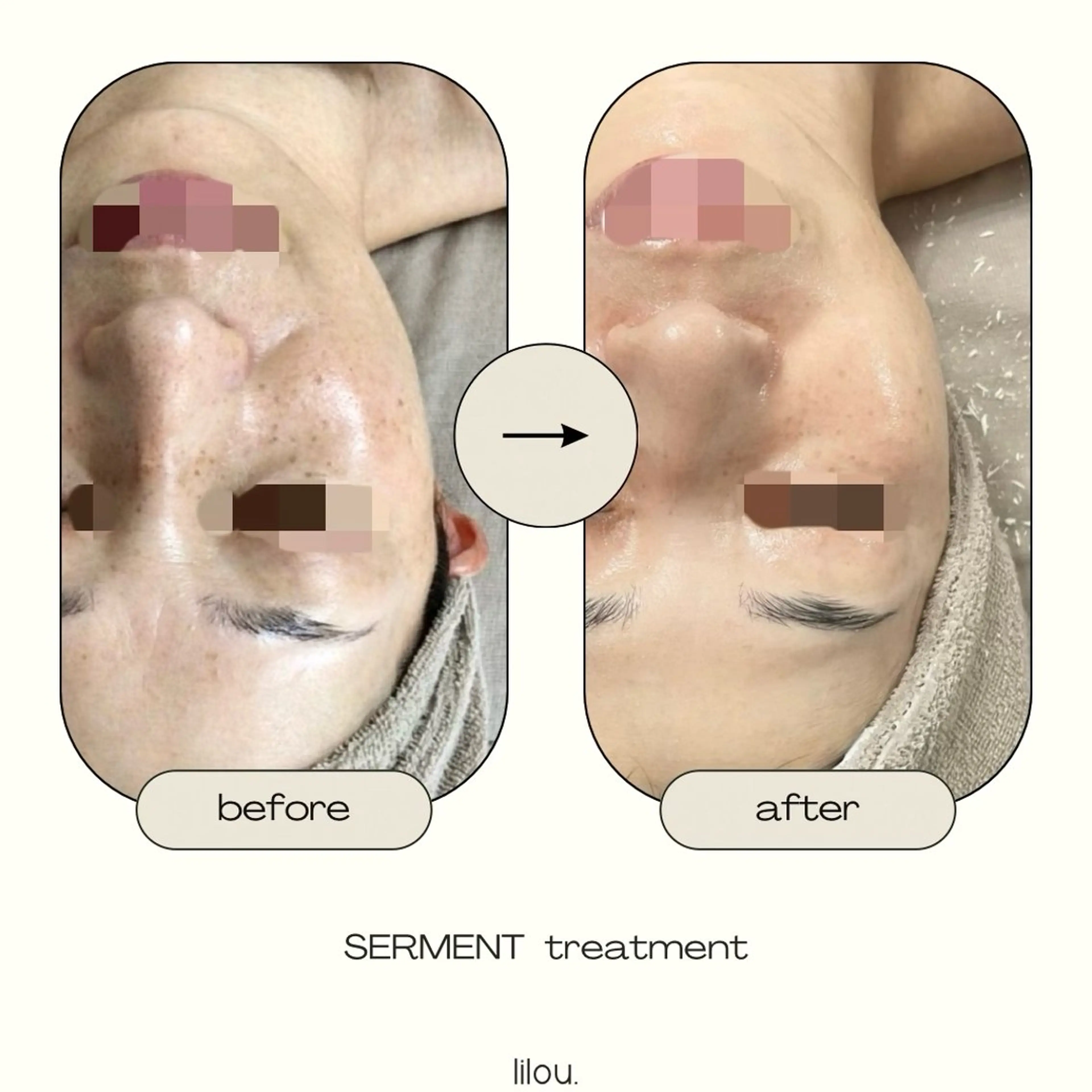 エステ hue.所属・LAND YUKAのエステ・リラクイメージ