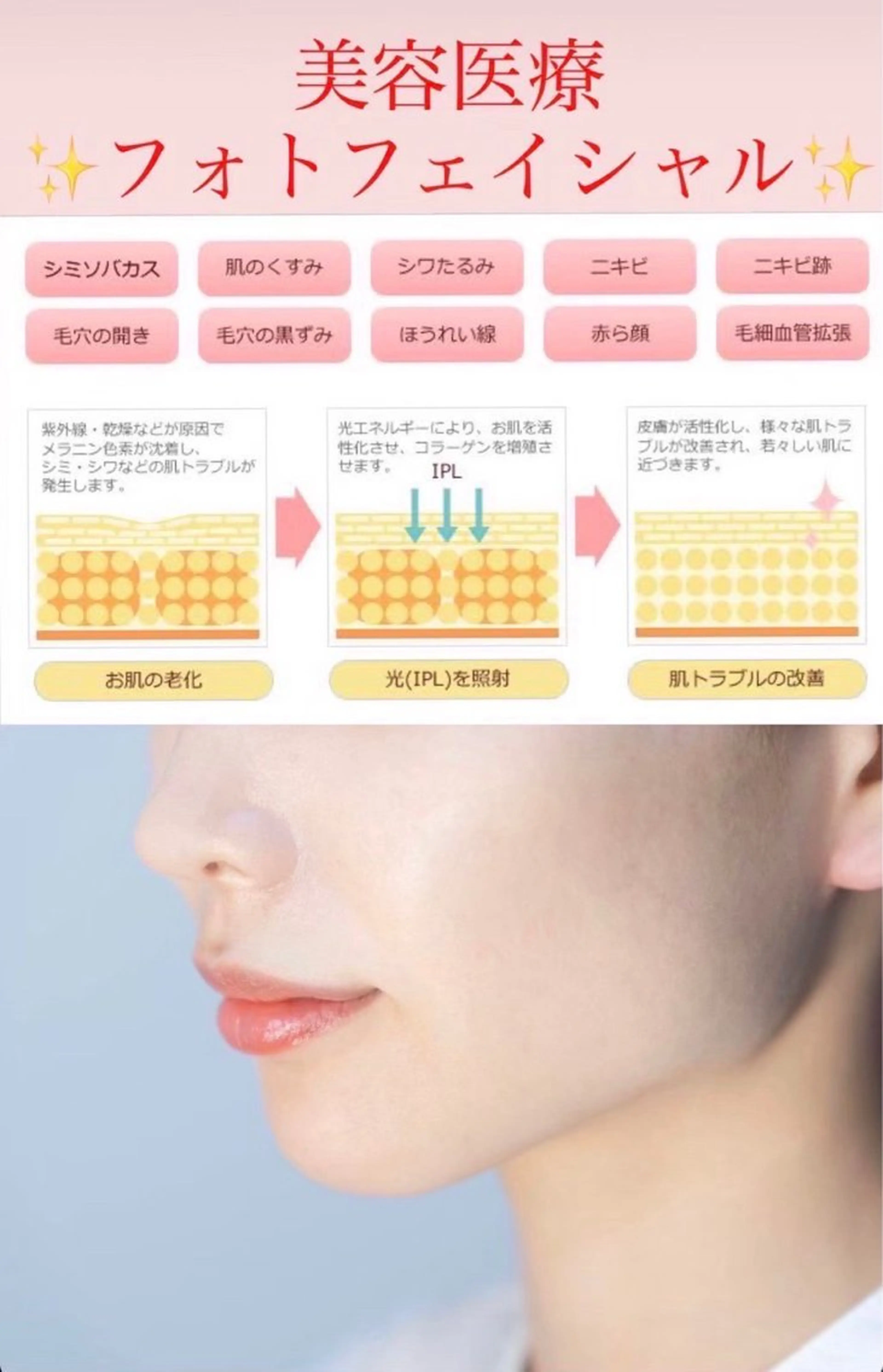 メンズ 脱毛SALON RaYNiCKのエステ・リラクイメージ