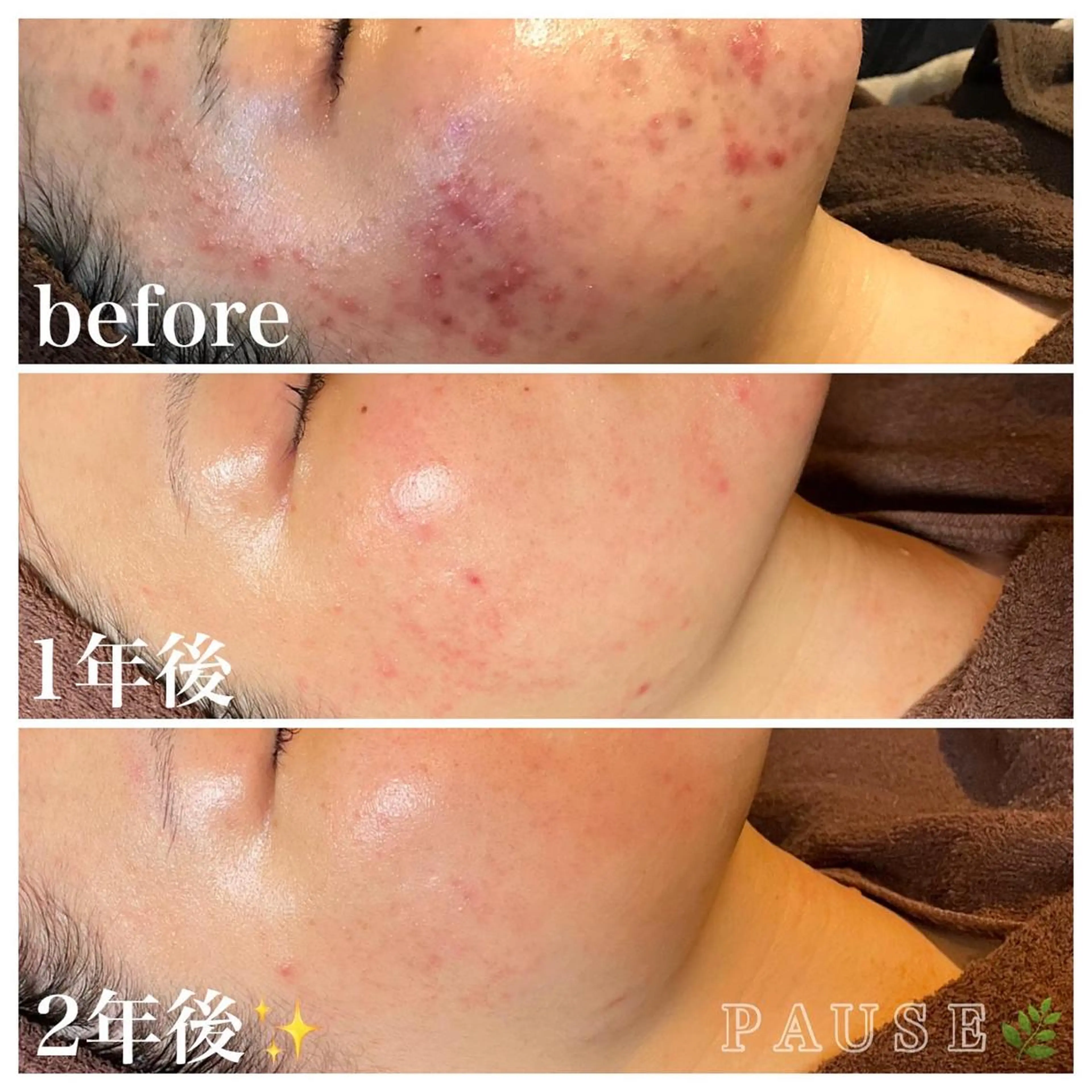 エステ 浜野 恵美のエステ・リラクイメージ