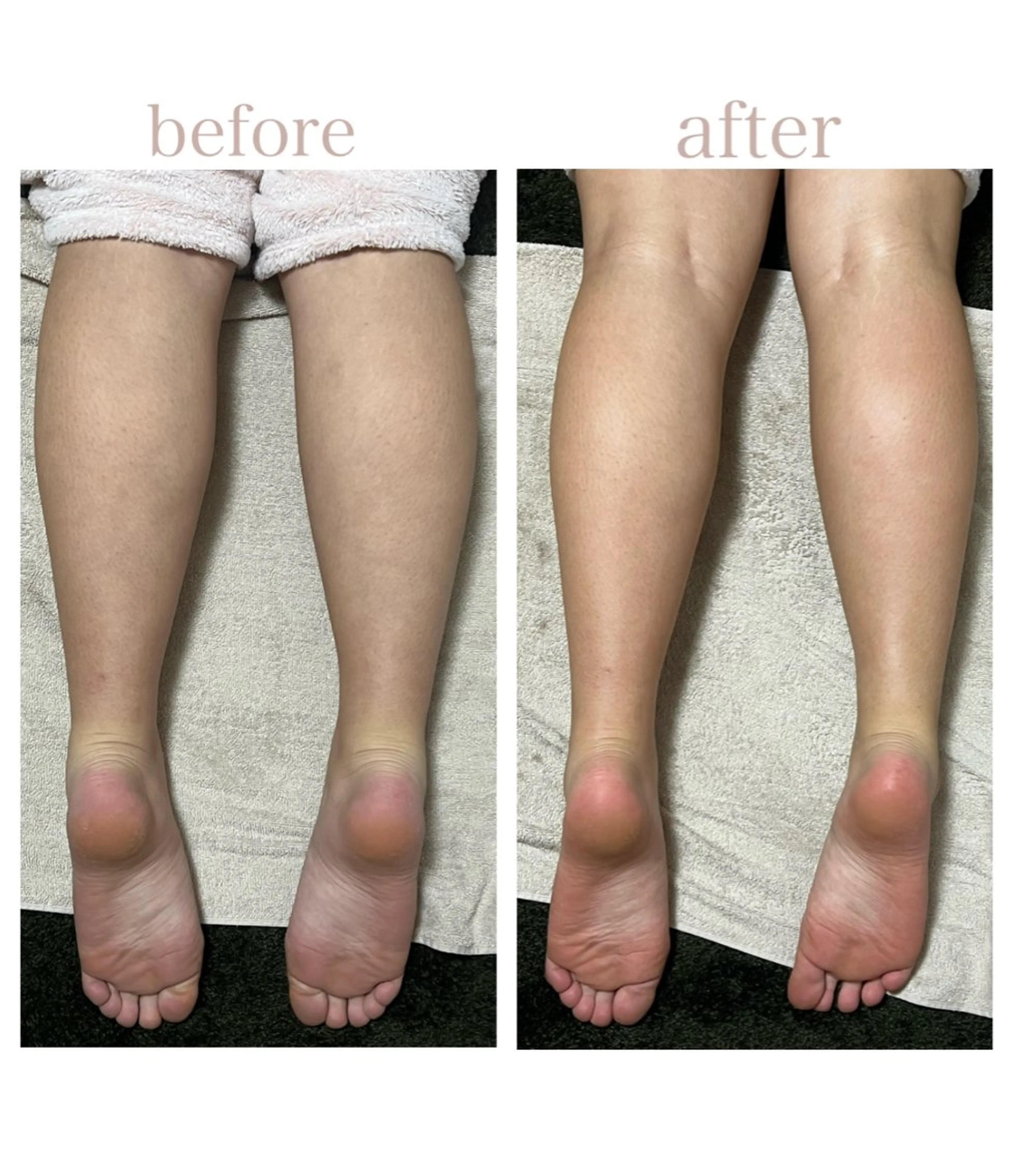 リンパ🌿リラクゼーション【60分】の写真