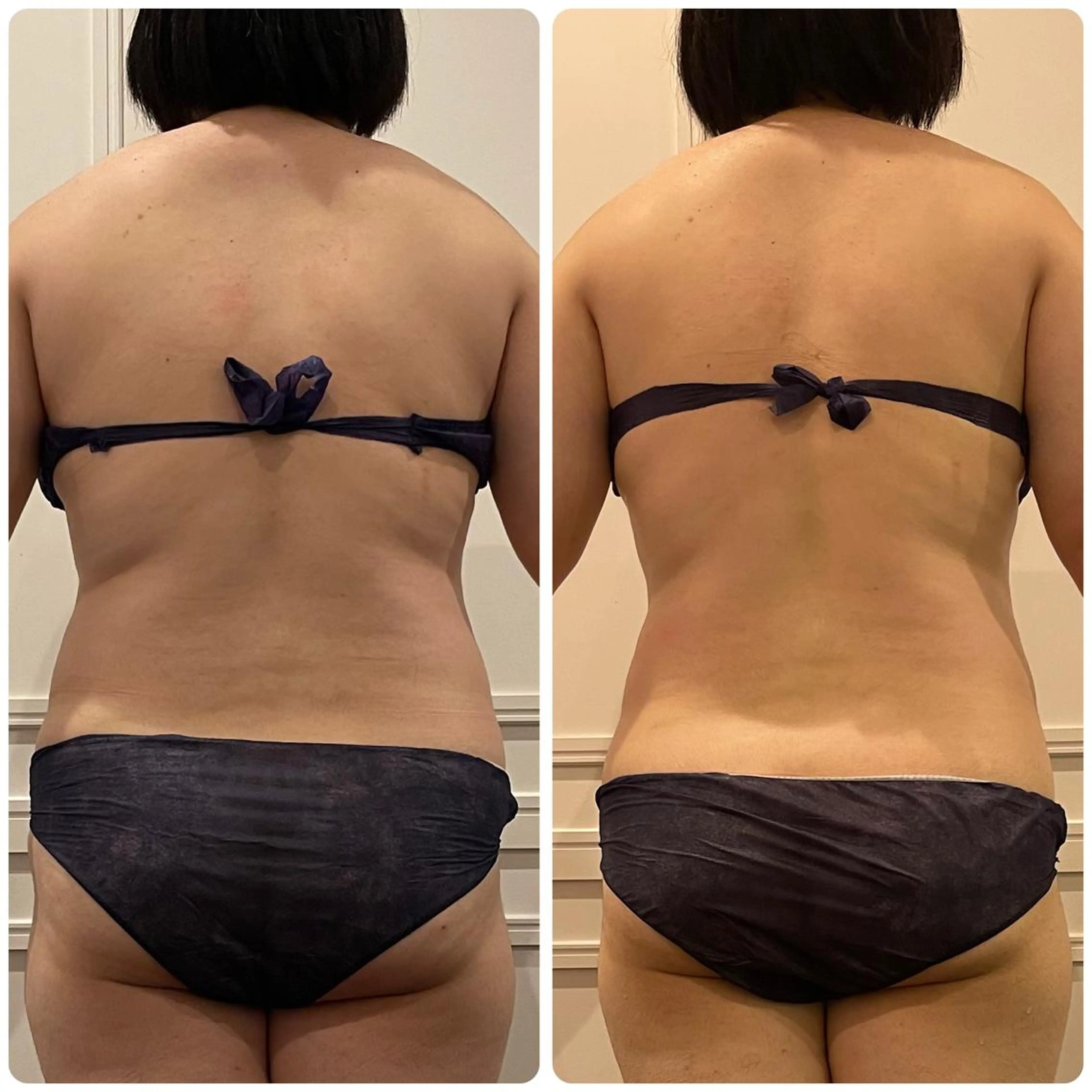 立体小顔×艶肌×美ボ ディ似合わせ施術 岡のエステ・リラクイメージ