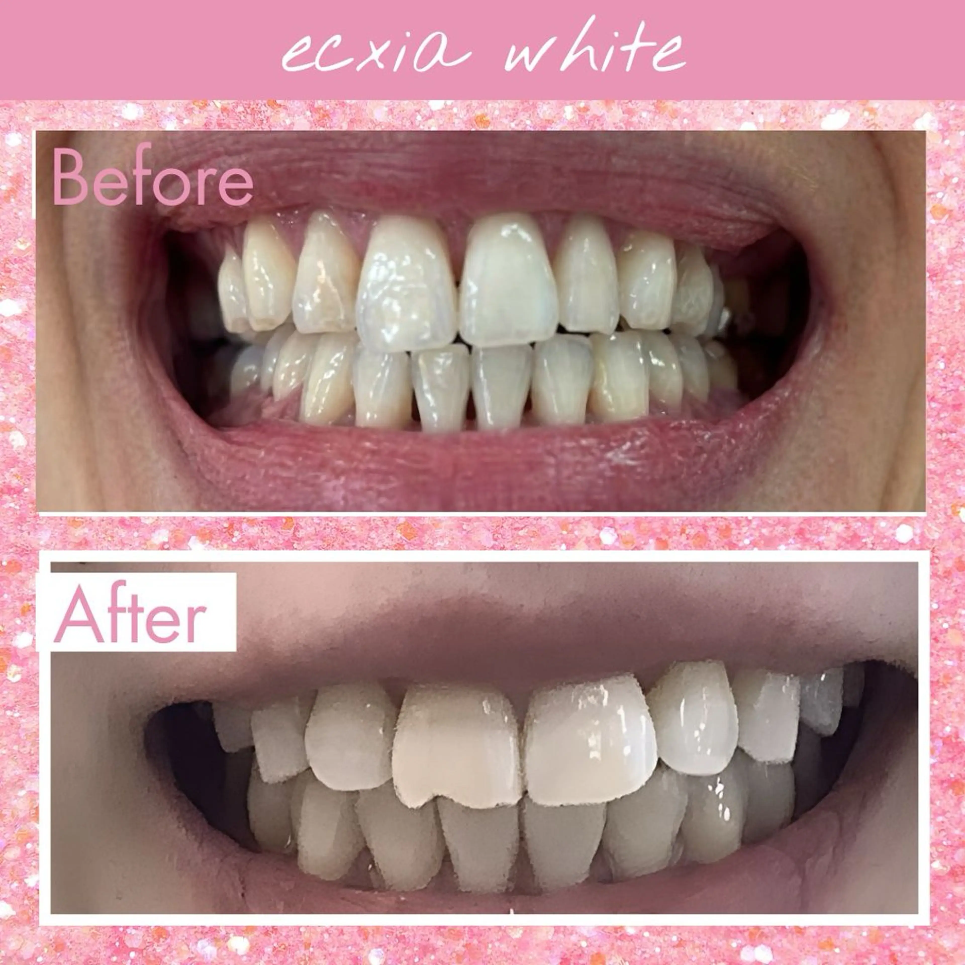 セルフホワイトニング エクシア戸田公園店所属・セルフホワイトニング エクシア戸田公園店のその他イメージ