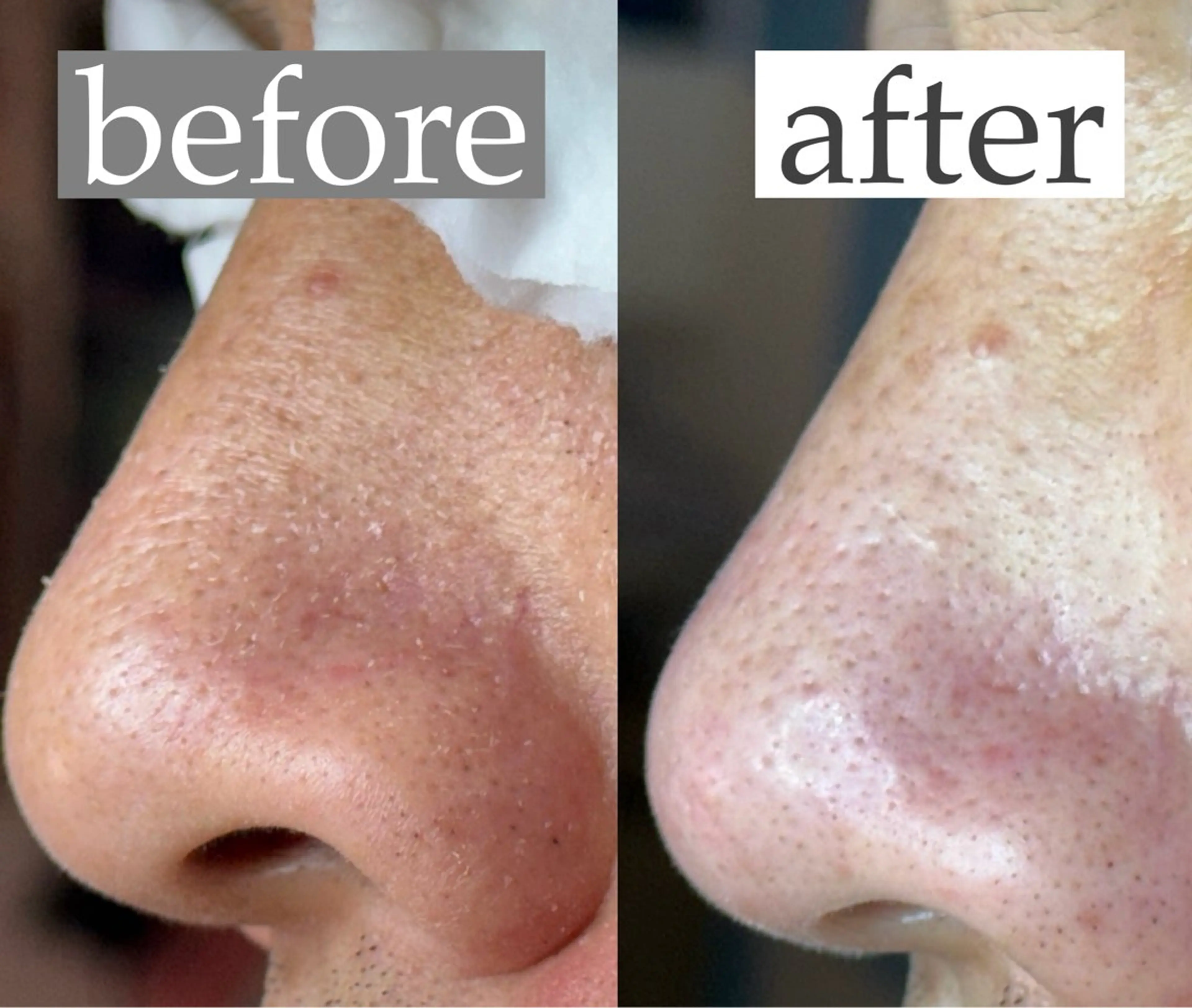 毛穴専門サロン ライカブルーのエステ・リラクイメージ