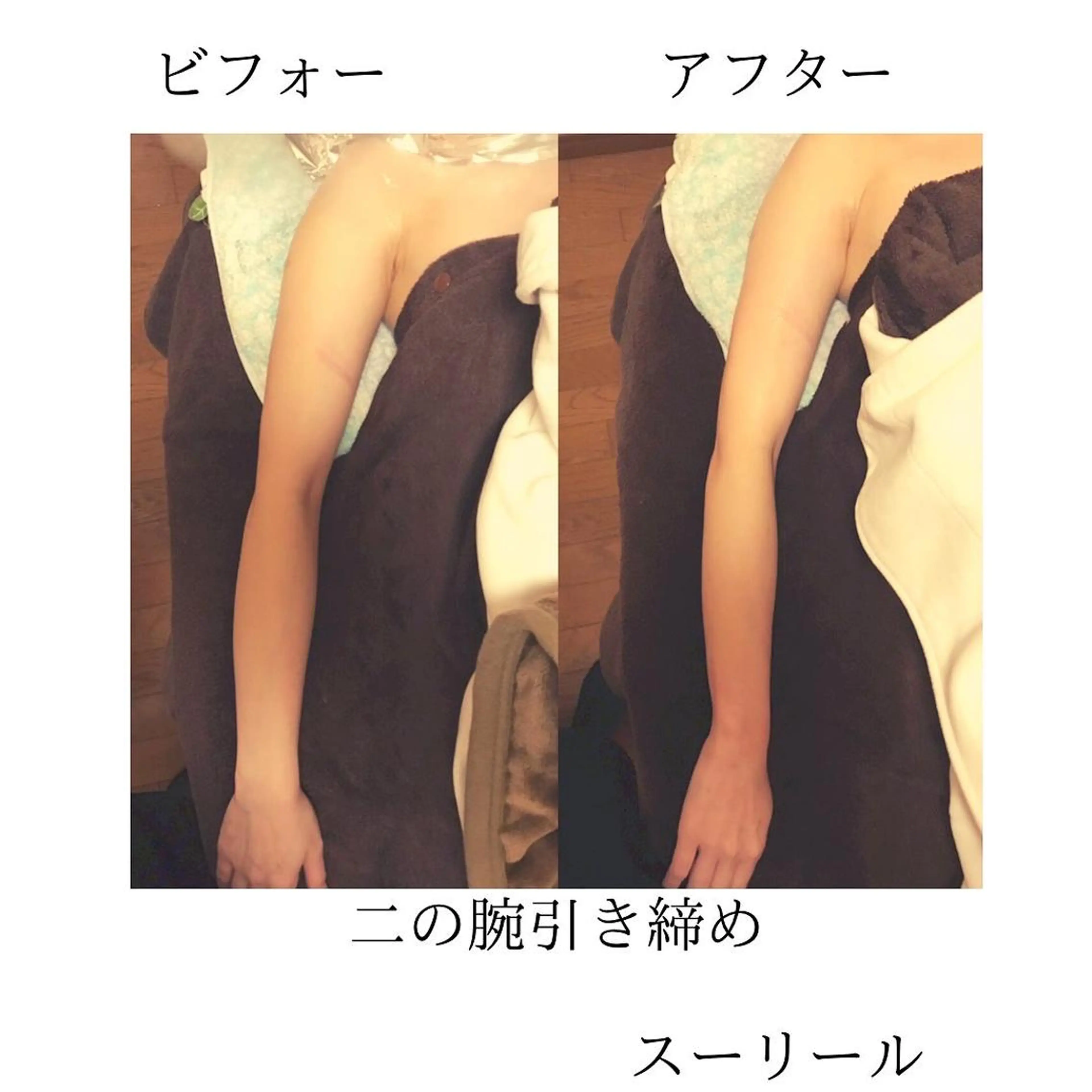 二の腕　ざらつき　二の腕ほっそり美肌酵素エステの写真