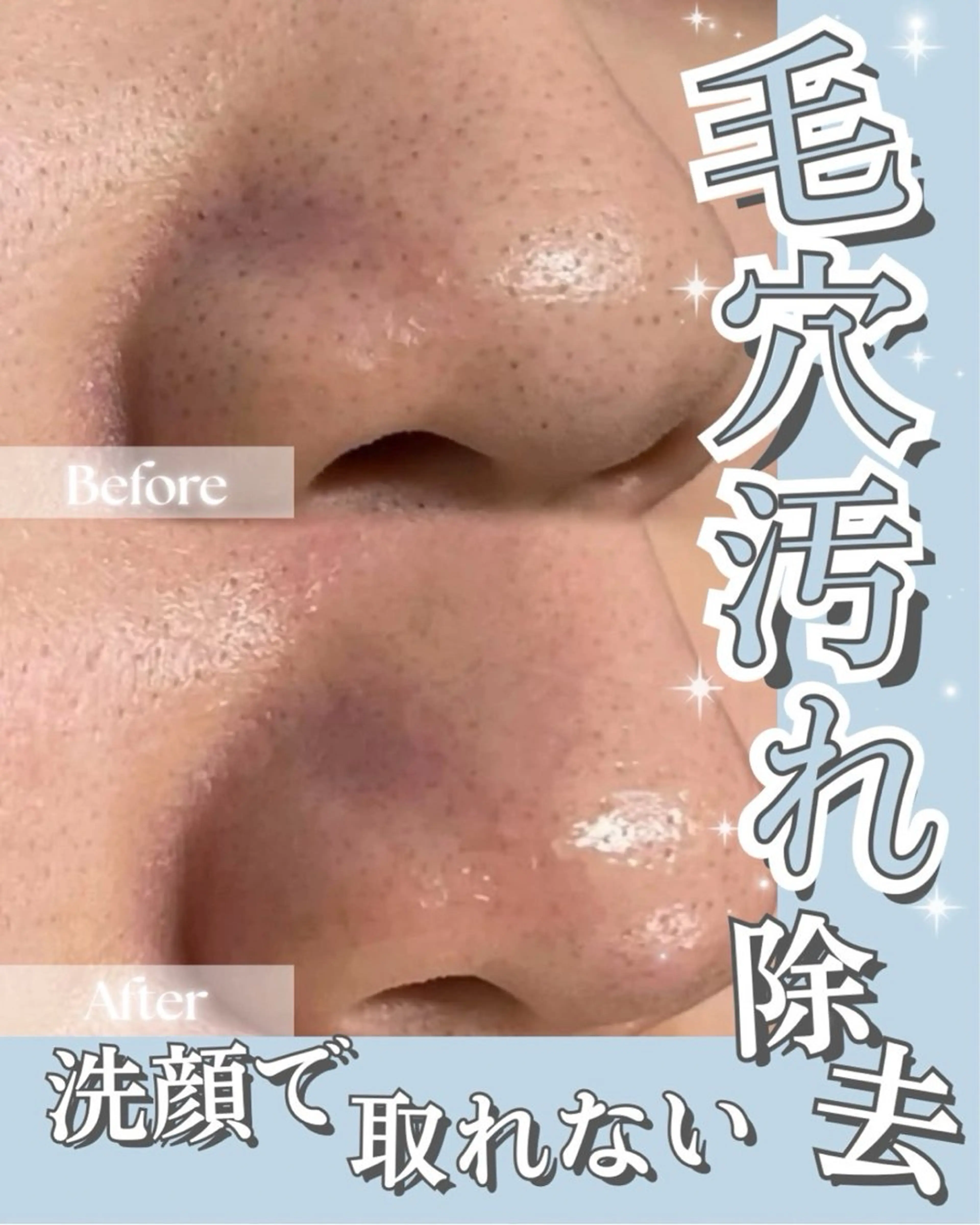 けいこ꙳✧˖° 脱毛￤エステのエステ・リラクイメージ