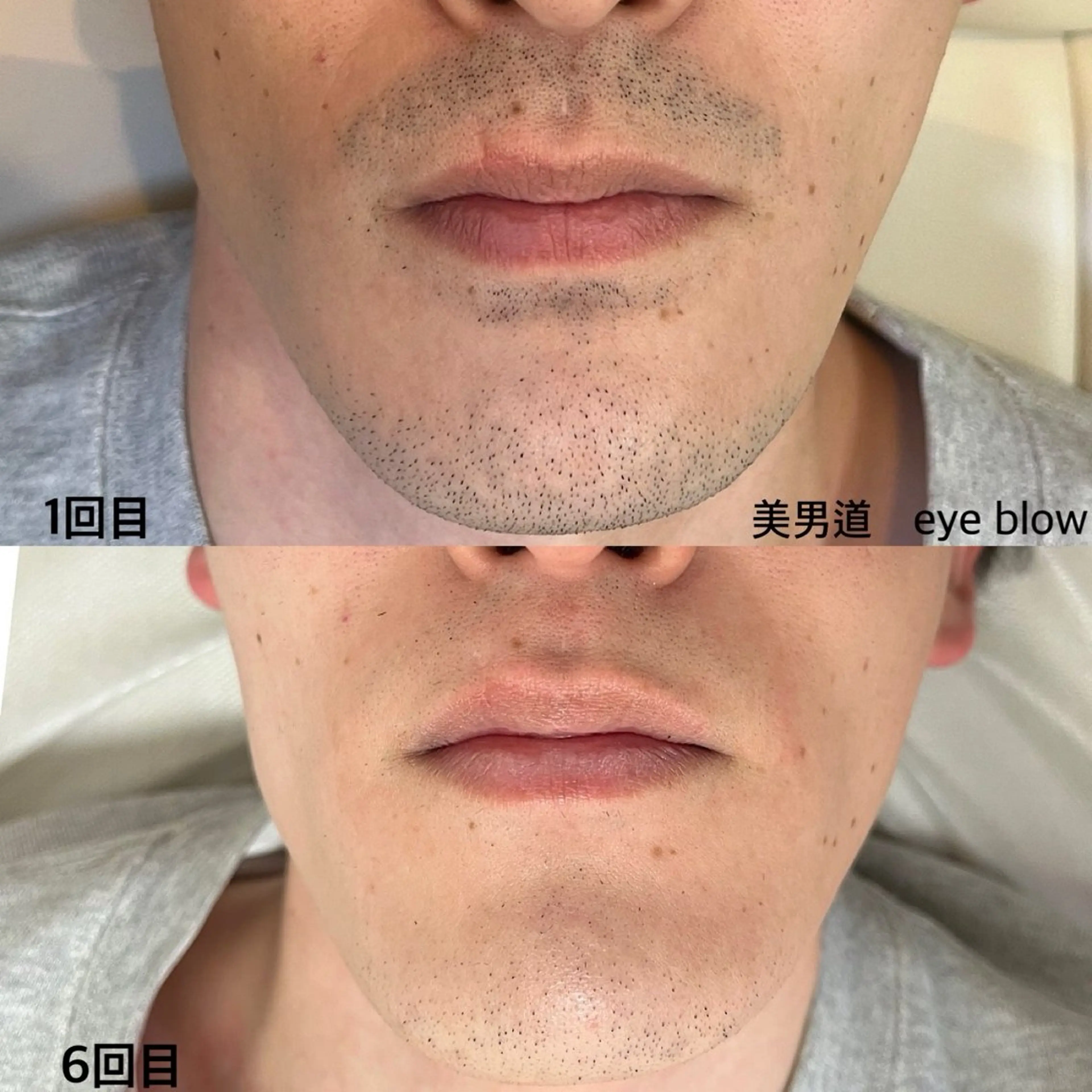 メンズ 脱毛 BINANDO 桑原の眉毛・アイブロウイメージ