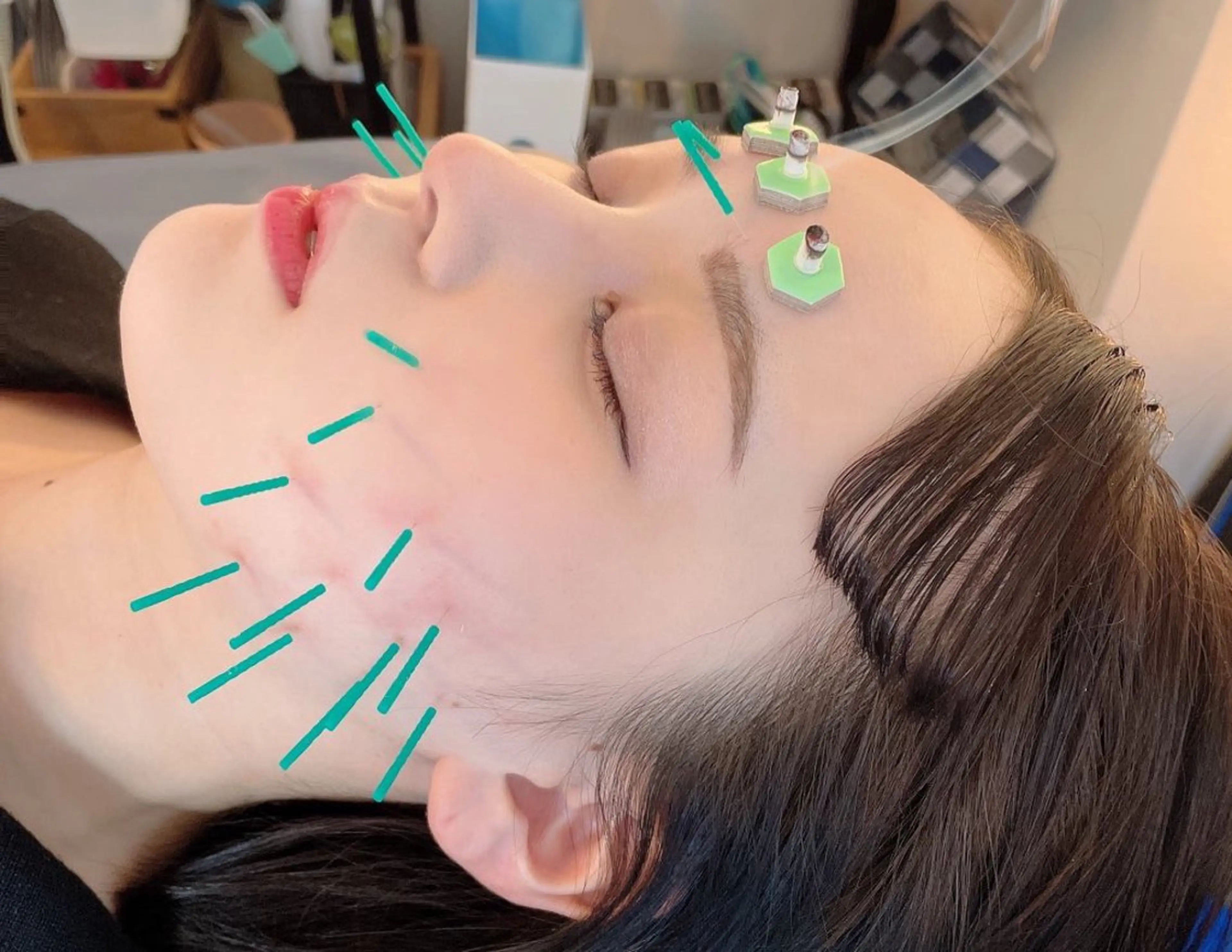 小顔美容鍼専門サロン 渋谷YZのエステ・リラクイメージ