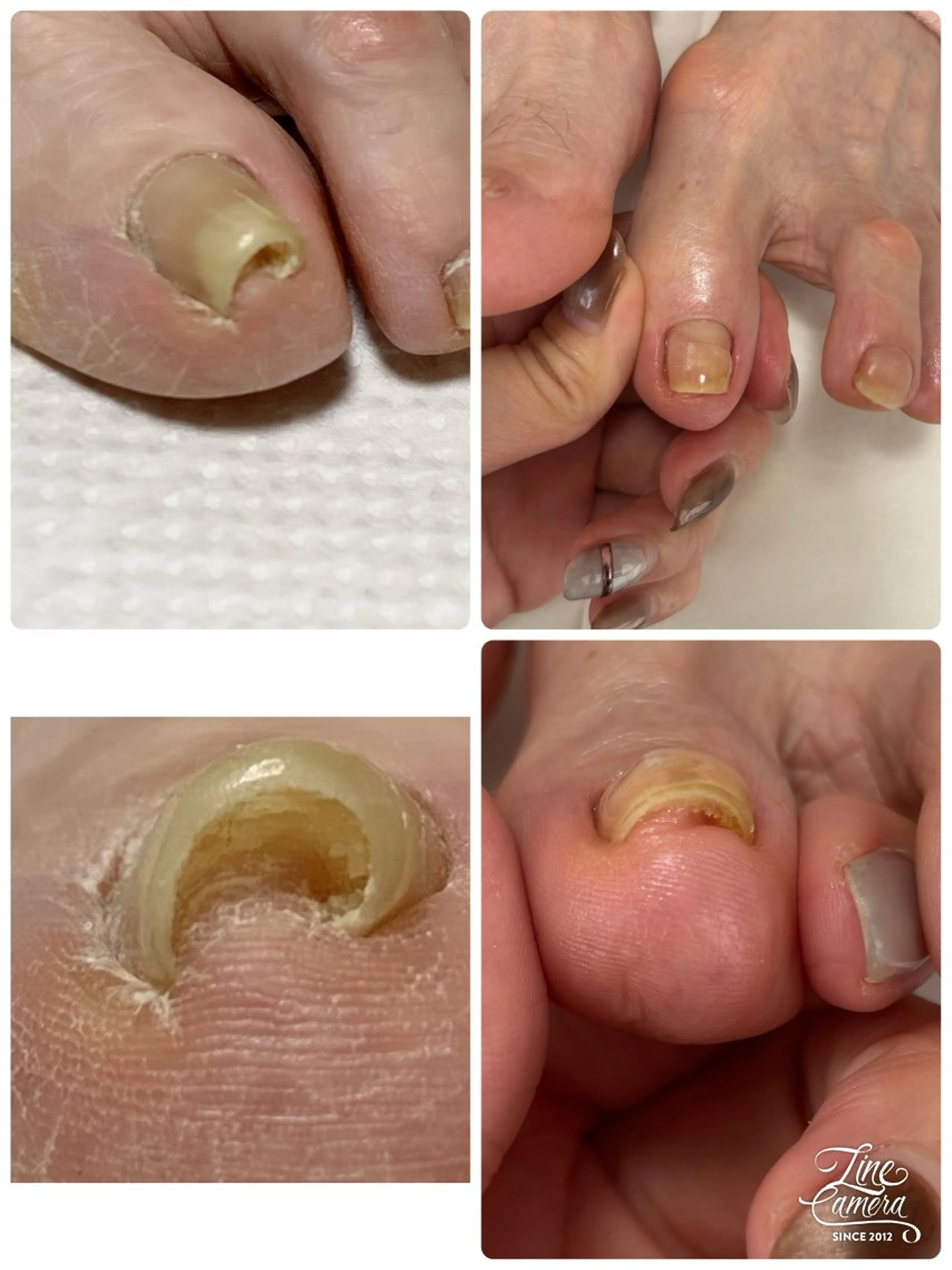 ネイル Alo.nail アロ•ネイルのネイルデザイン