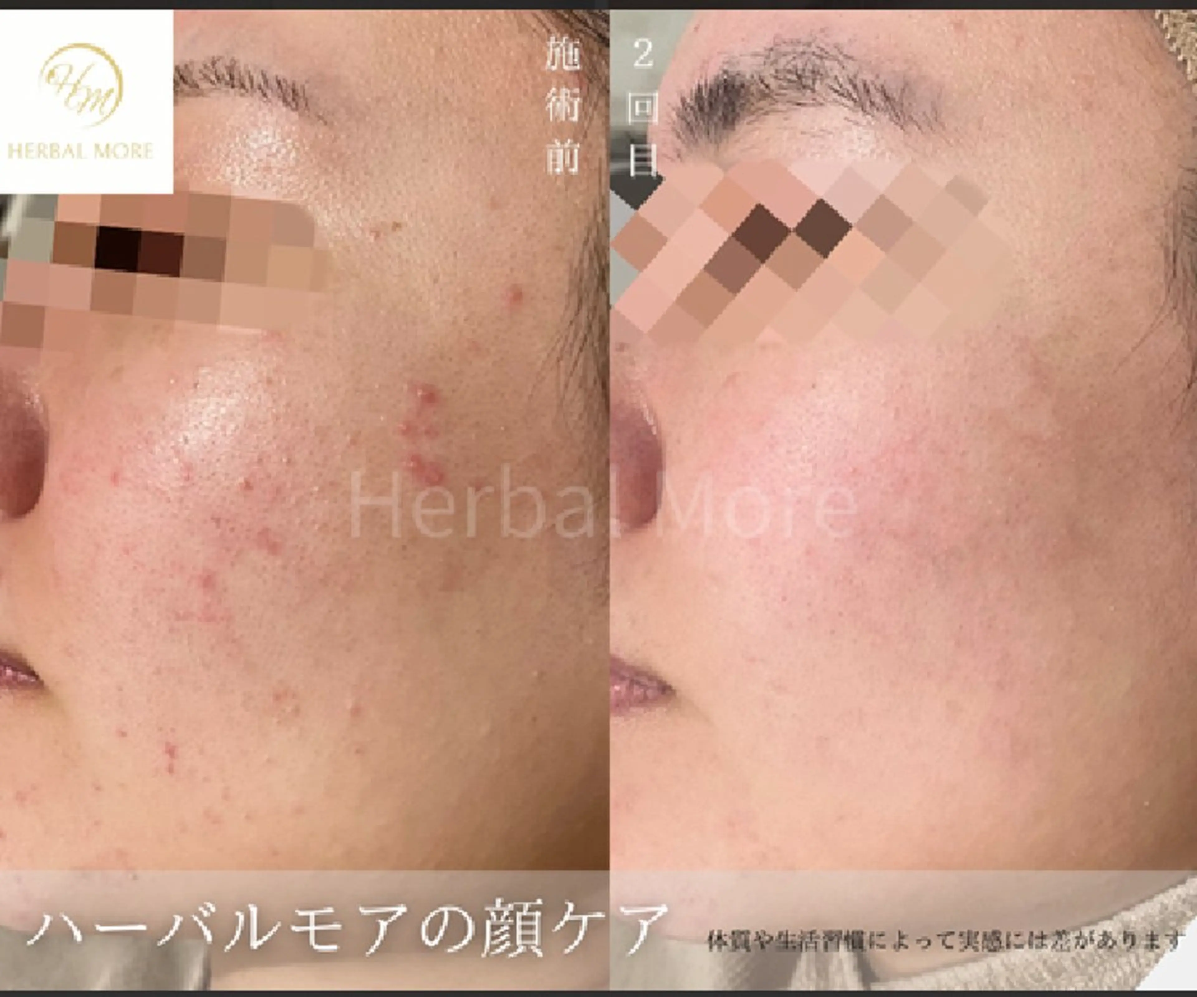 マツエク・マツパ hairsalon&eyelash  Jill所属・Jill Erikaのエステ・リラクイメージ