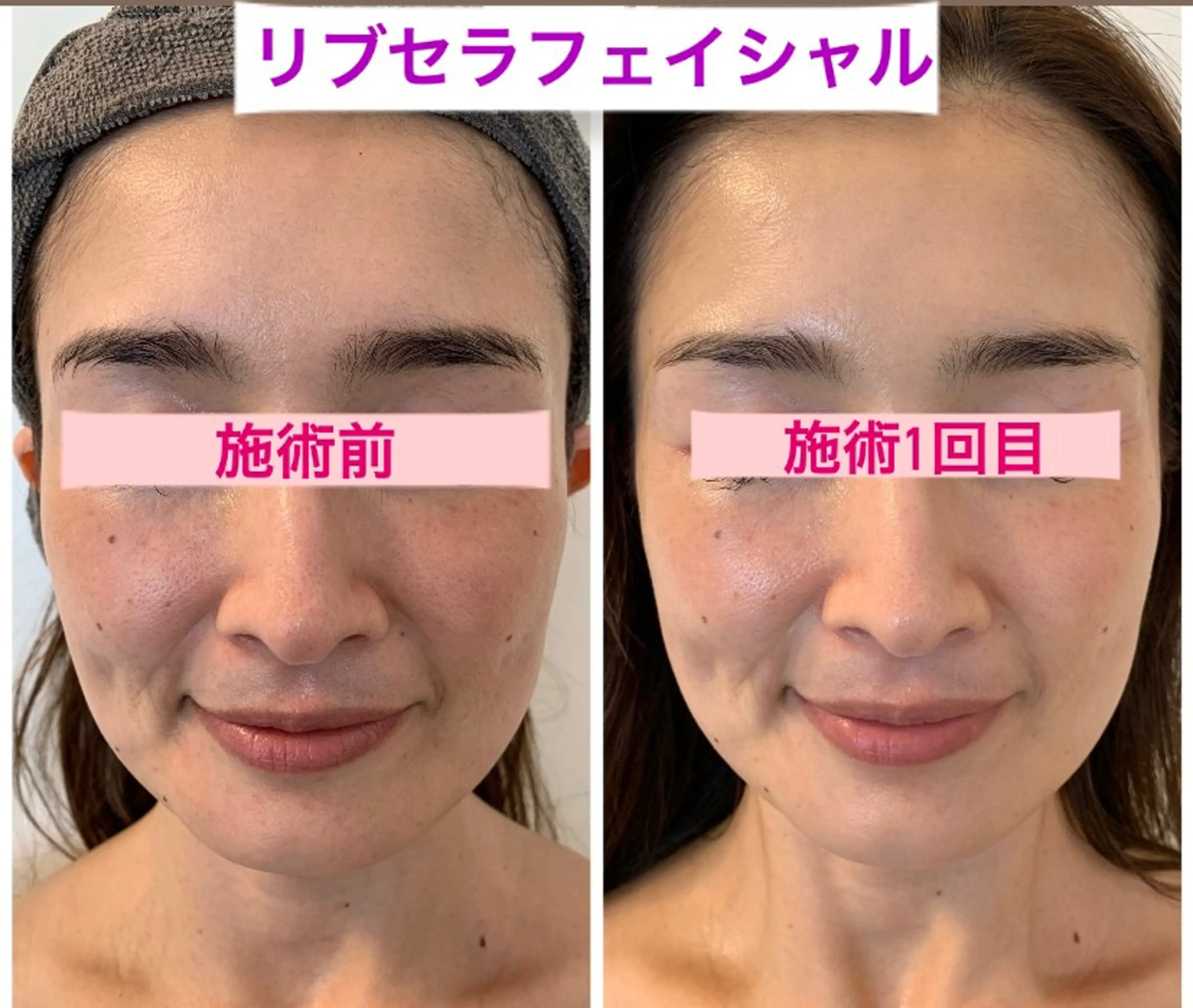 エステ Private Salon Prunelle所属・プライベートサロン プリュネルのエステ・リラクイメージ