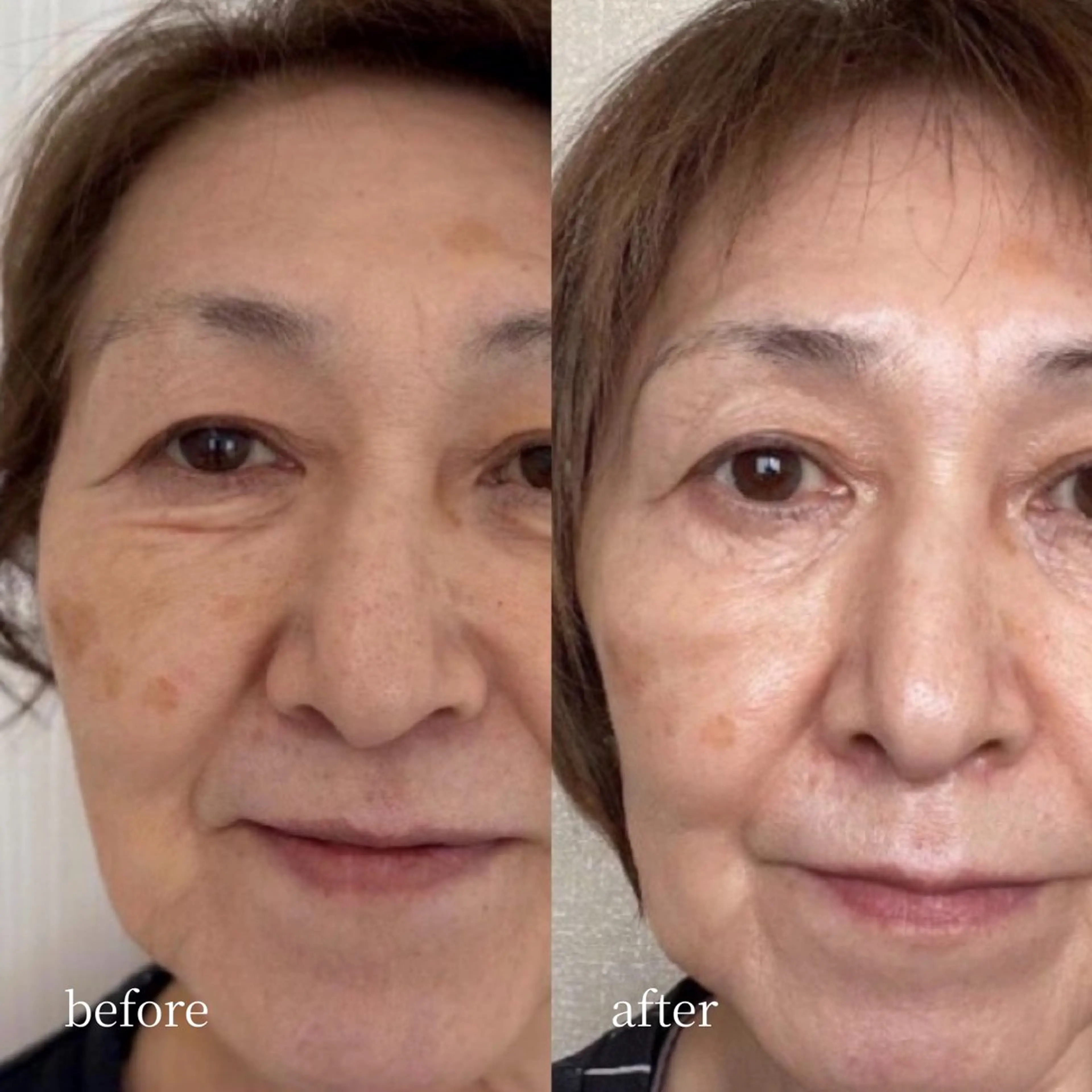 エステ 韓国肌管理・肌質改善 EARNEST心斎橋のエステ・リラクイメージ