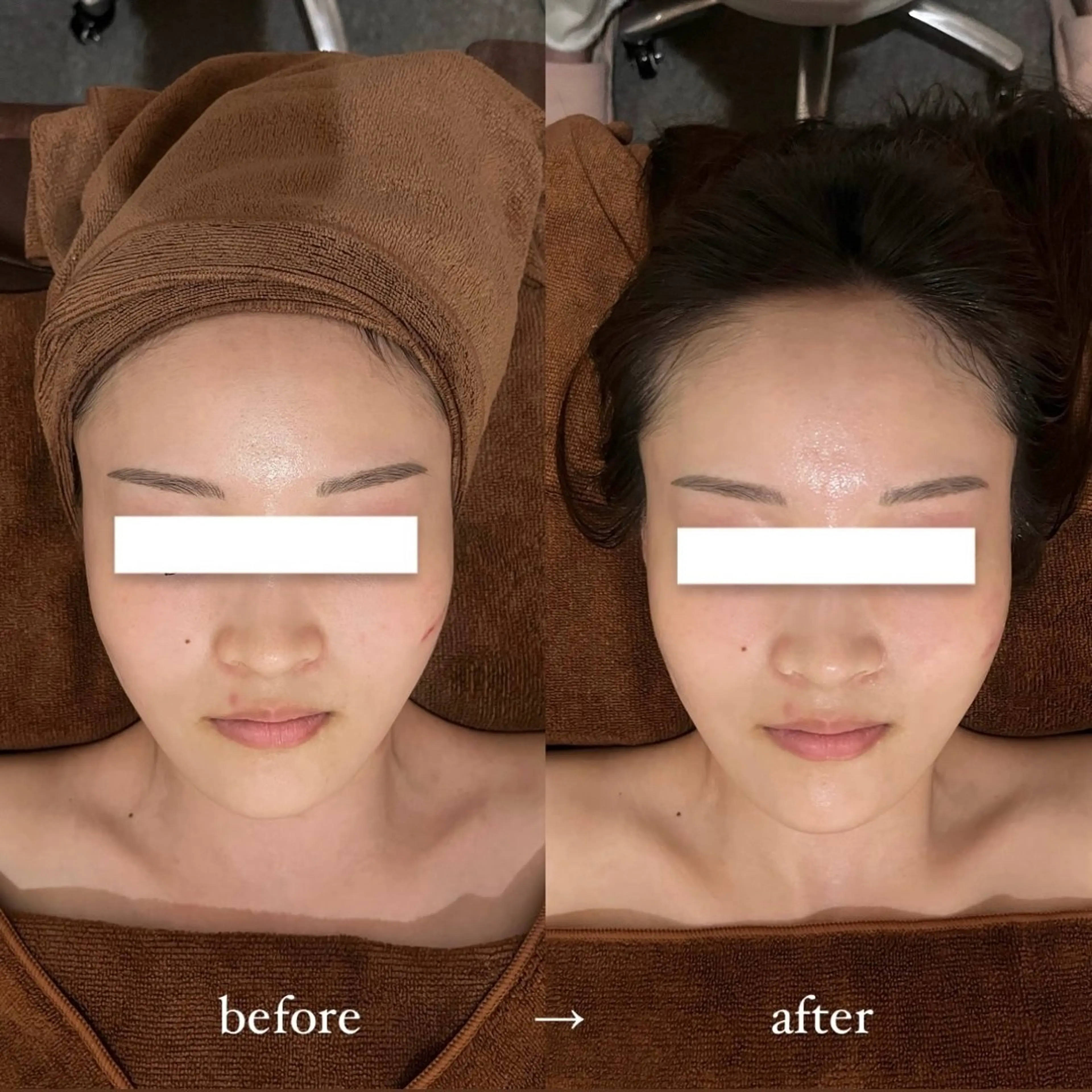 NOEL所属・フェイシャルエステ Utaiのエステ・リラクイメージ