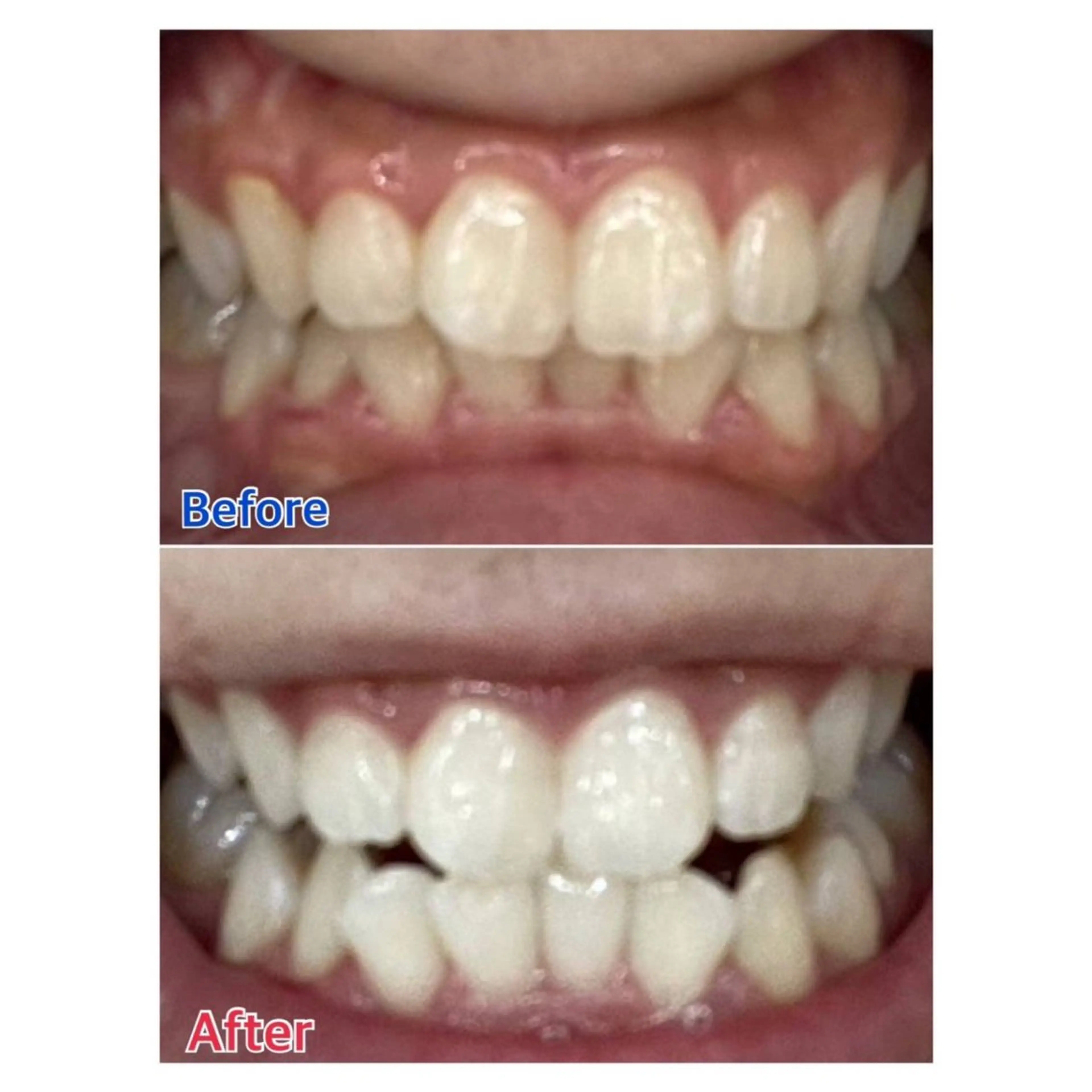 MBEAUTYSALON 千葉店・京成大久保所属・Melty 輝のその他イメージ