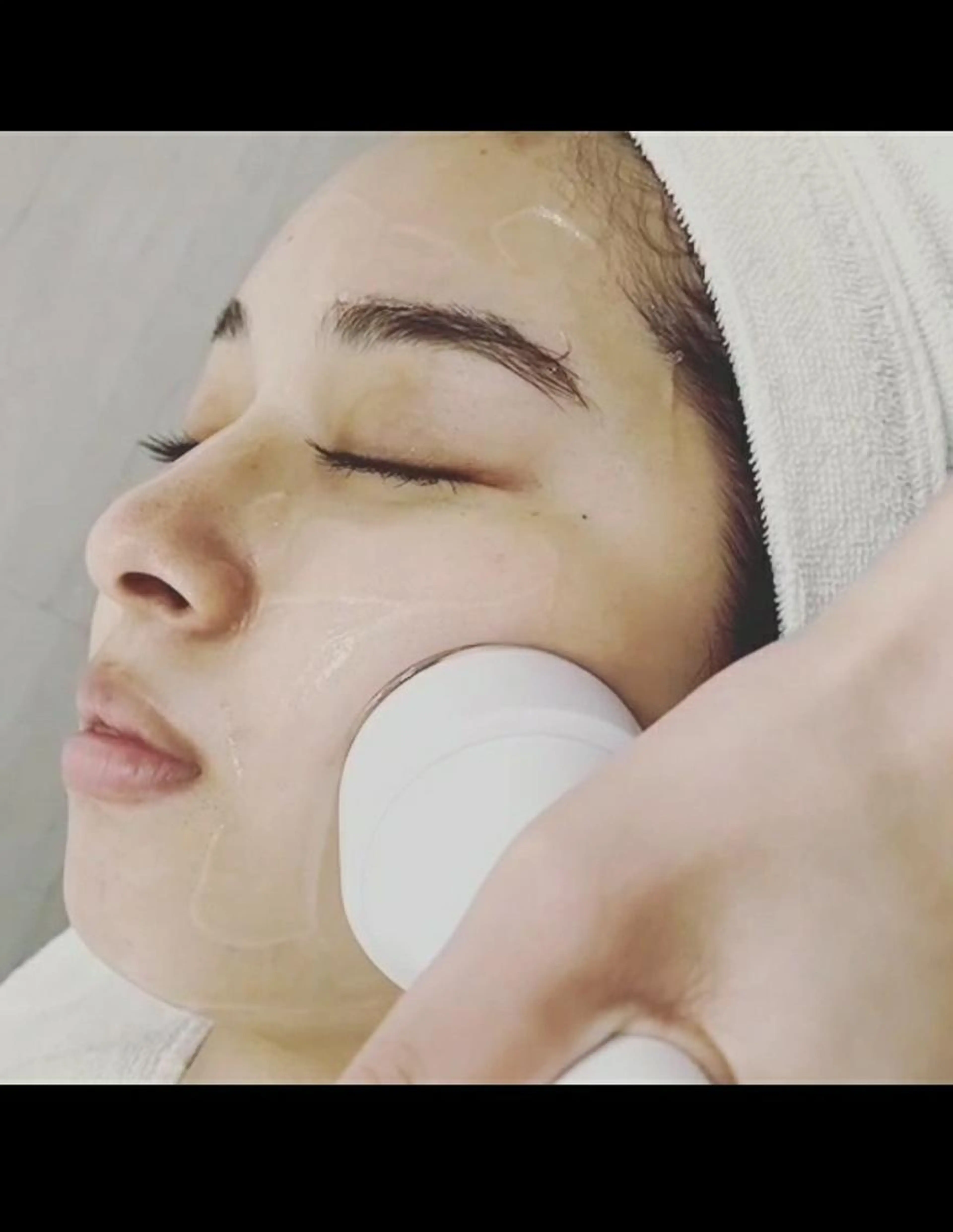 超音波毛穴クレンジングの写真