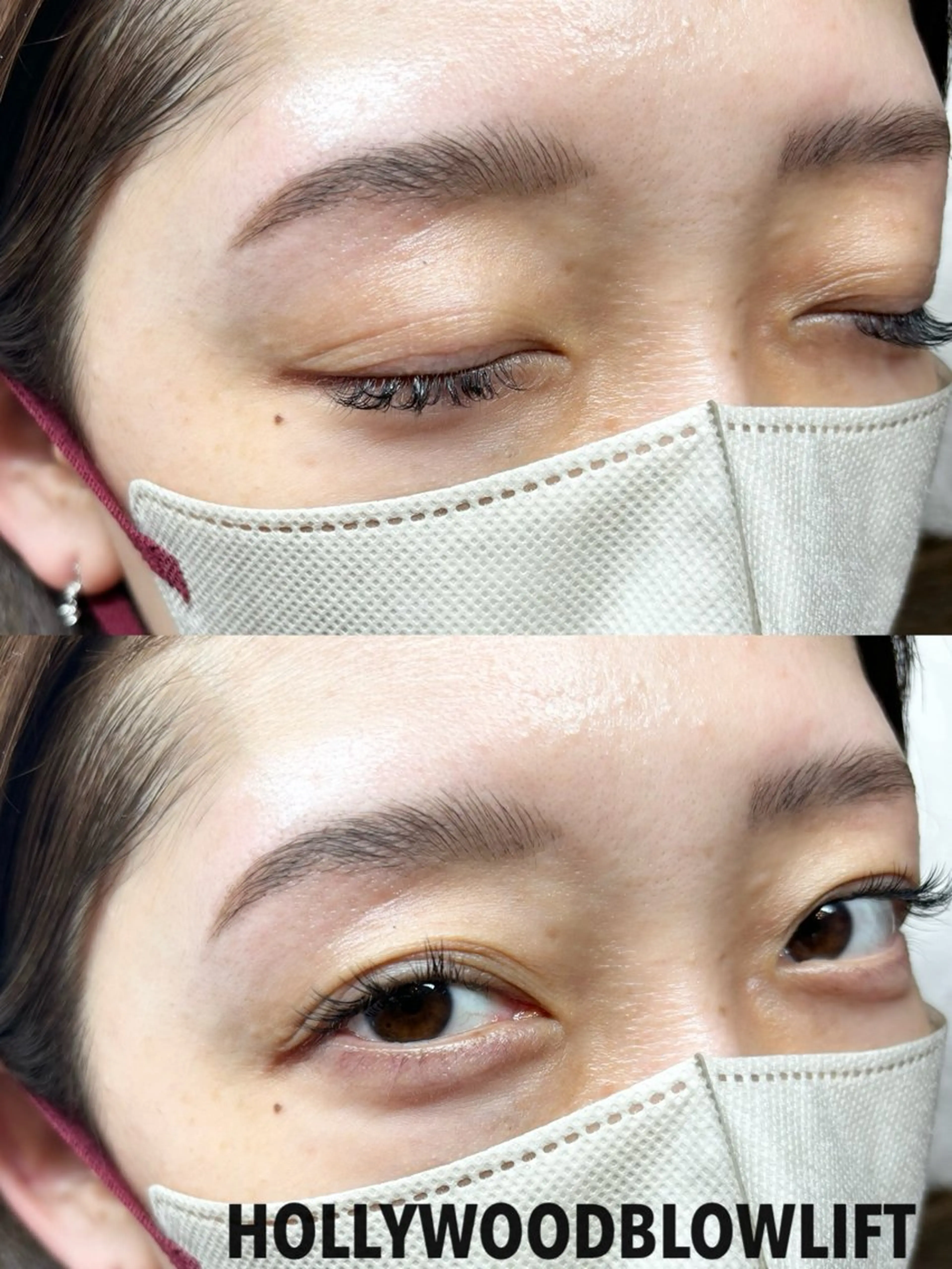 人気👑No.1❤️‍🔥❤️‍🔥HBL×ハリウッドブロウリフト眉癖改善(おでこパーツまたは眉毛美容液 BTX付き)の写真