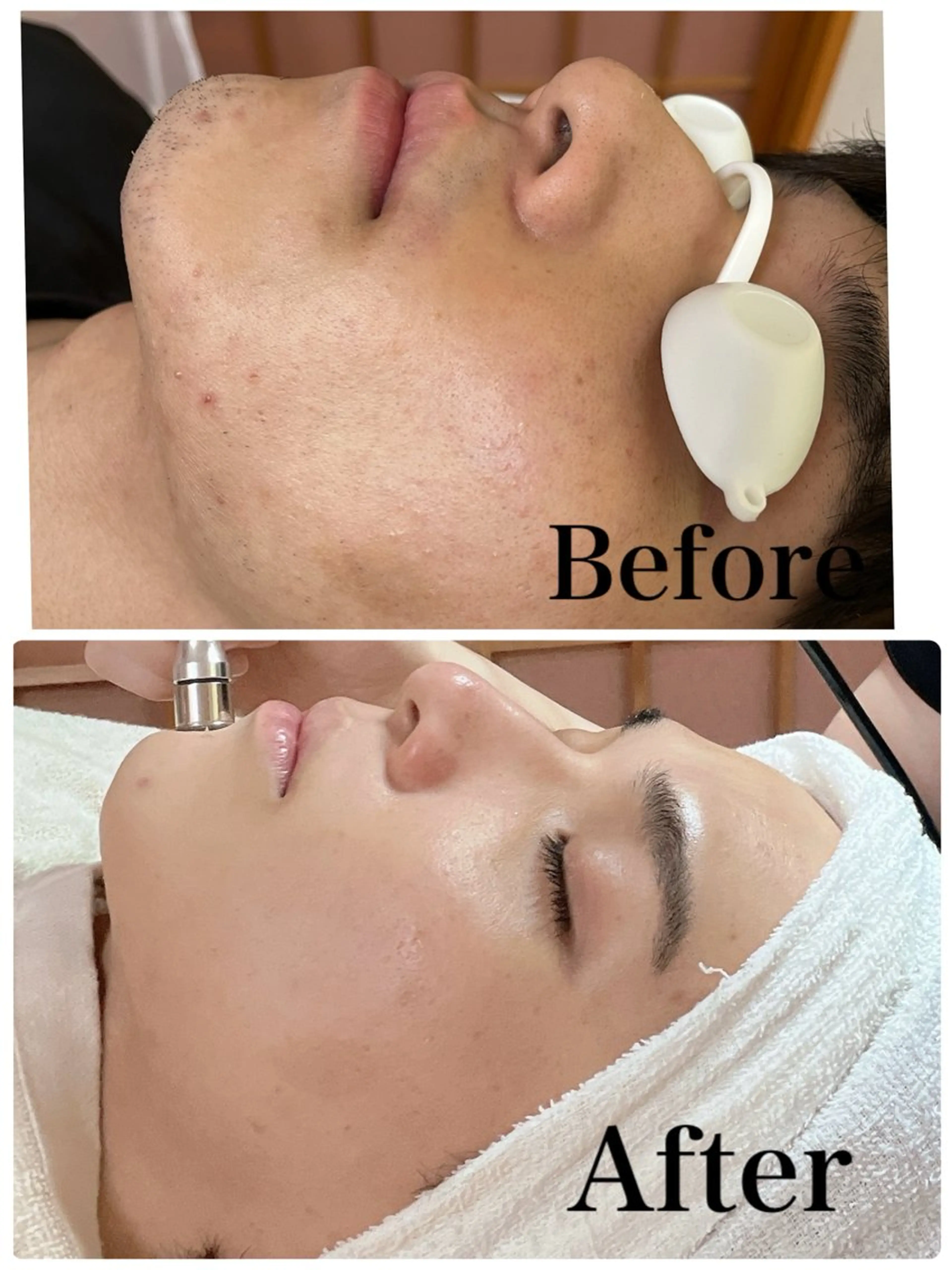 メンズ private salon OUKA所属・OUKA脱毛 毛穴ケアフェイシャルのエステ・リラクイメージ