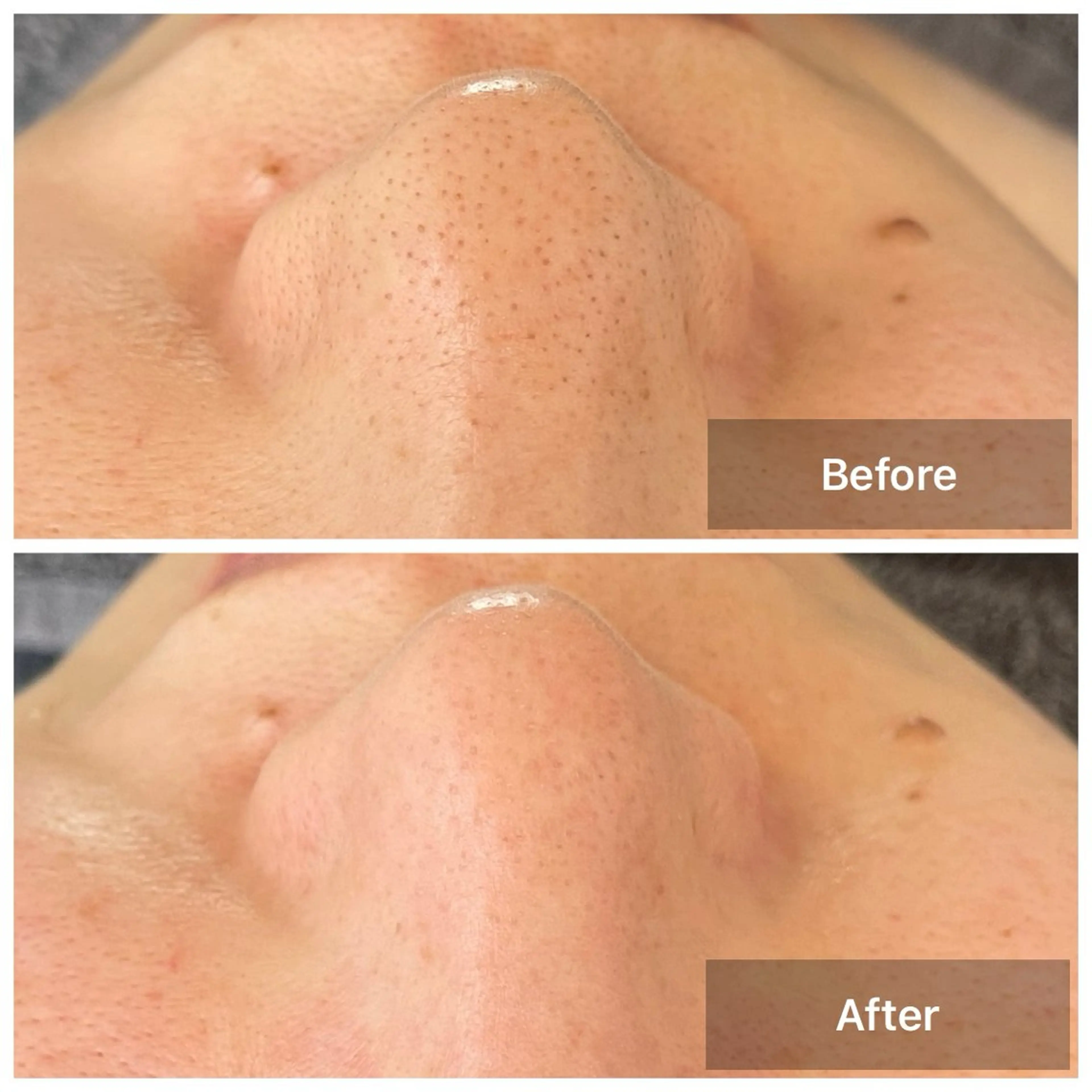 エステ リラク 隠れ家サロン STELLA☆のエステ・リラクイメージ