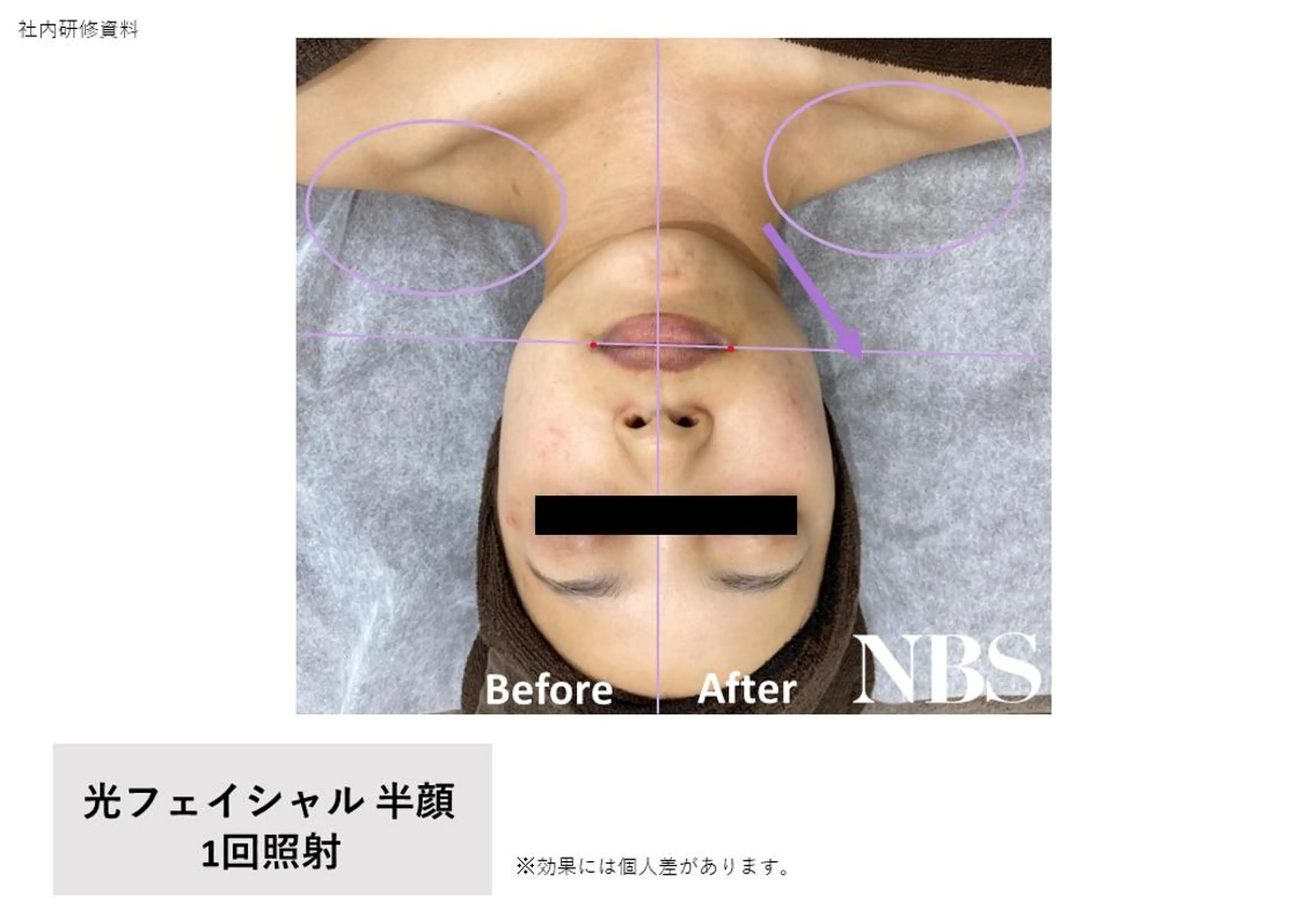 痩身・脱毛・美髪ケア 【GLYCINE】のエステ・リラクイメージ