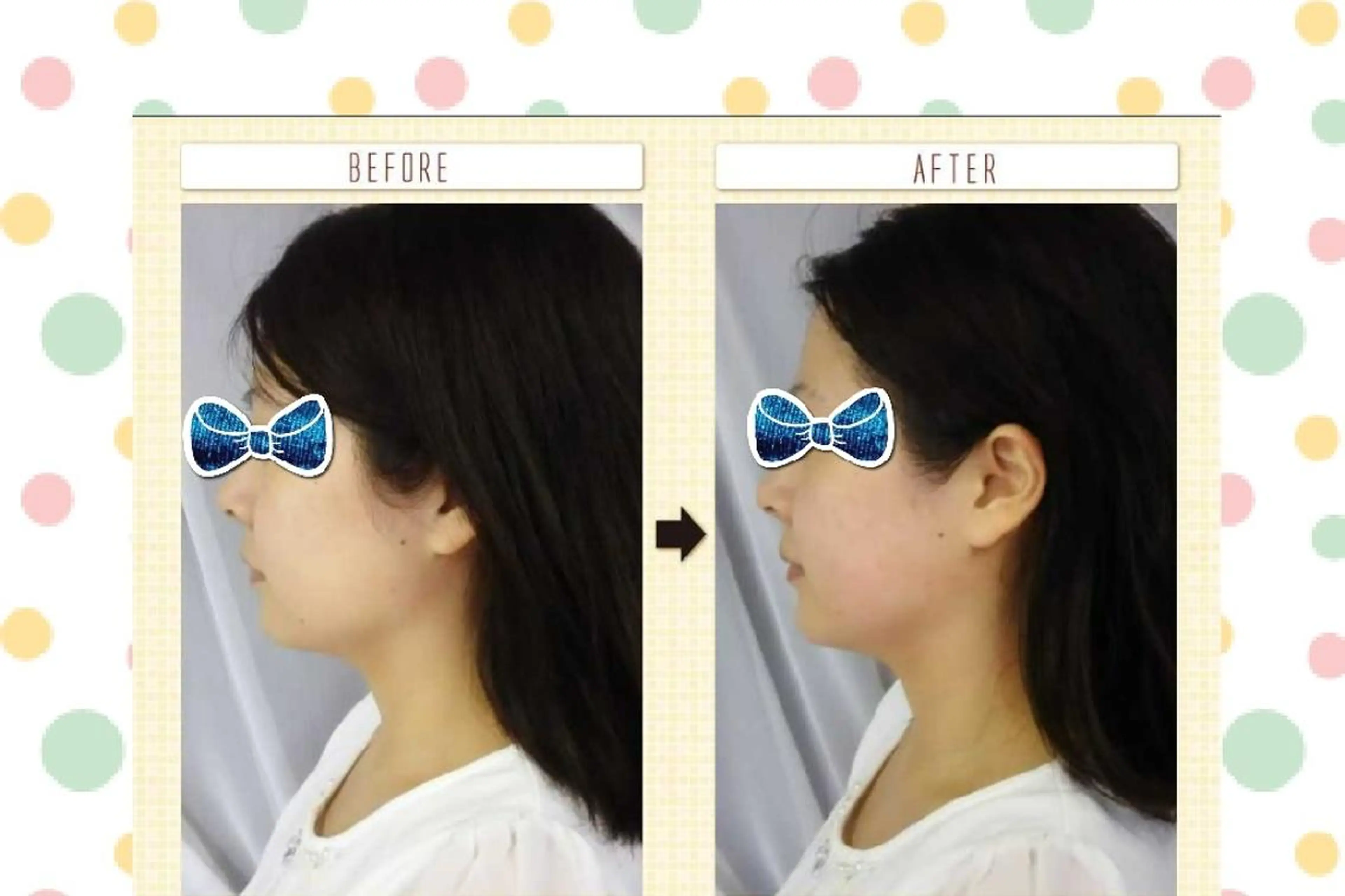 美顔ケアサロン ティアレのエステ・リラクイメージ