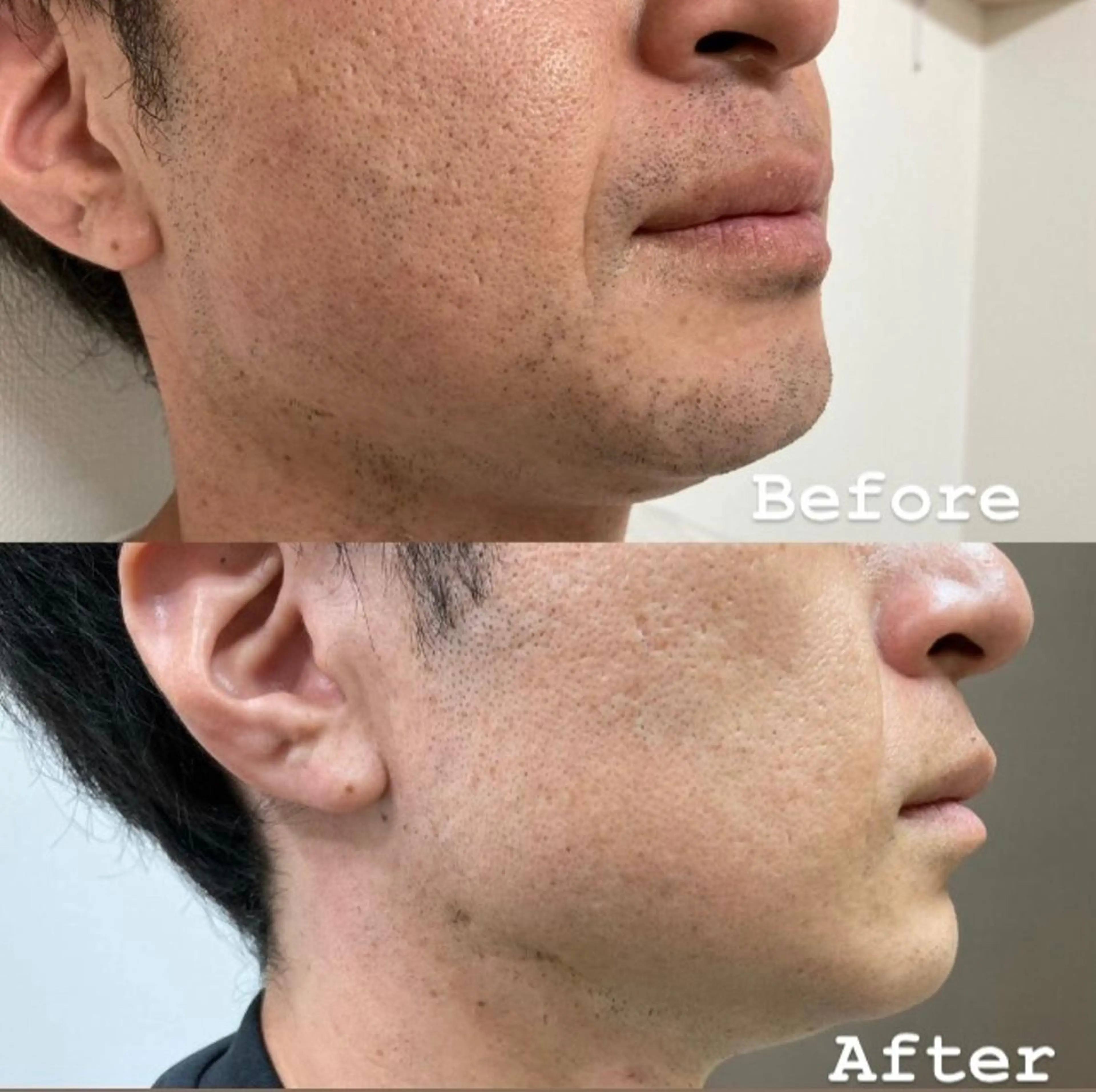 メンズ トータルビューティー サロンCherie2のエステ・リラクイメージ