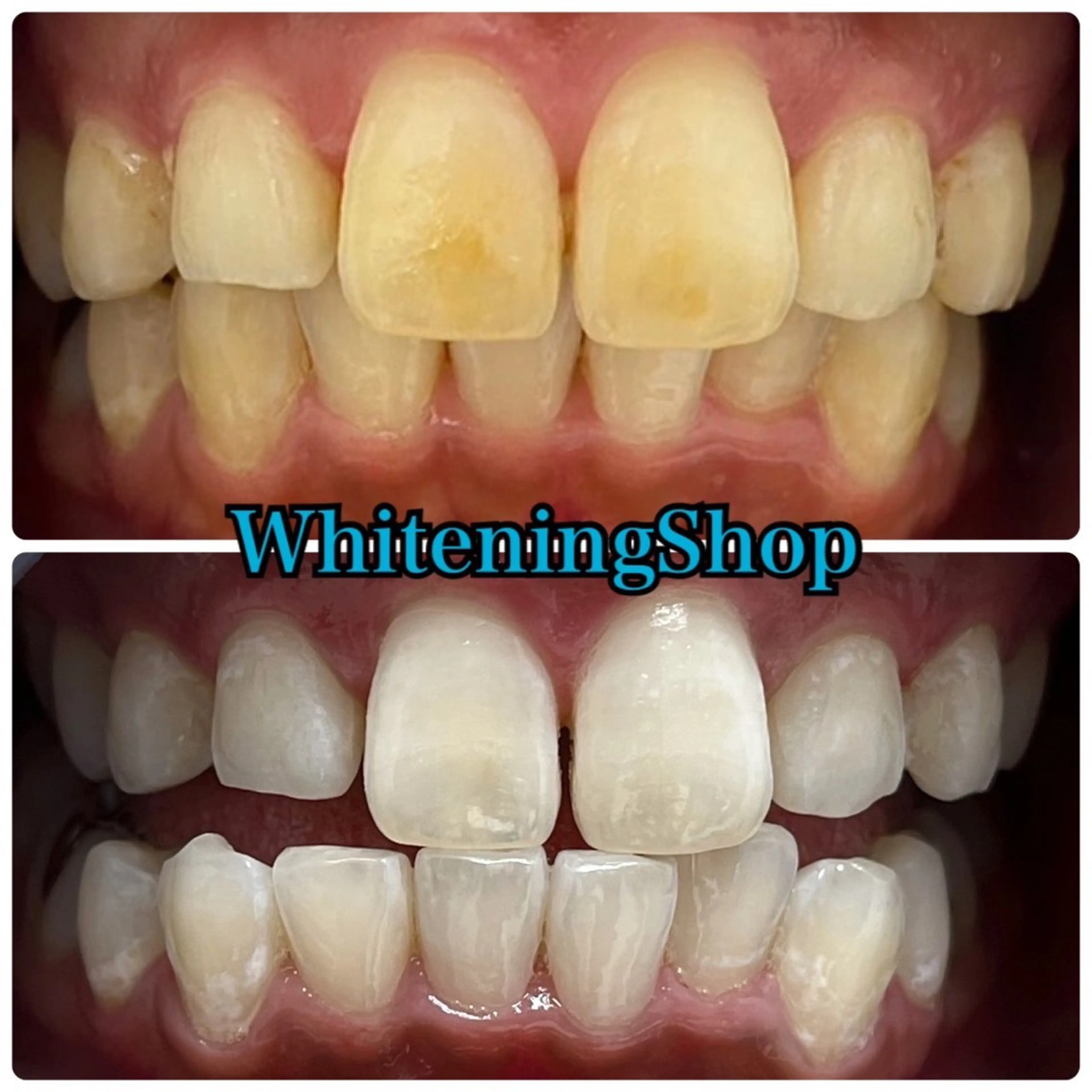 エステ リラク ホワイトニング ショップ吉祥寺店のエステ・リラクイメージ