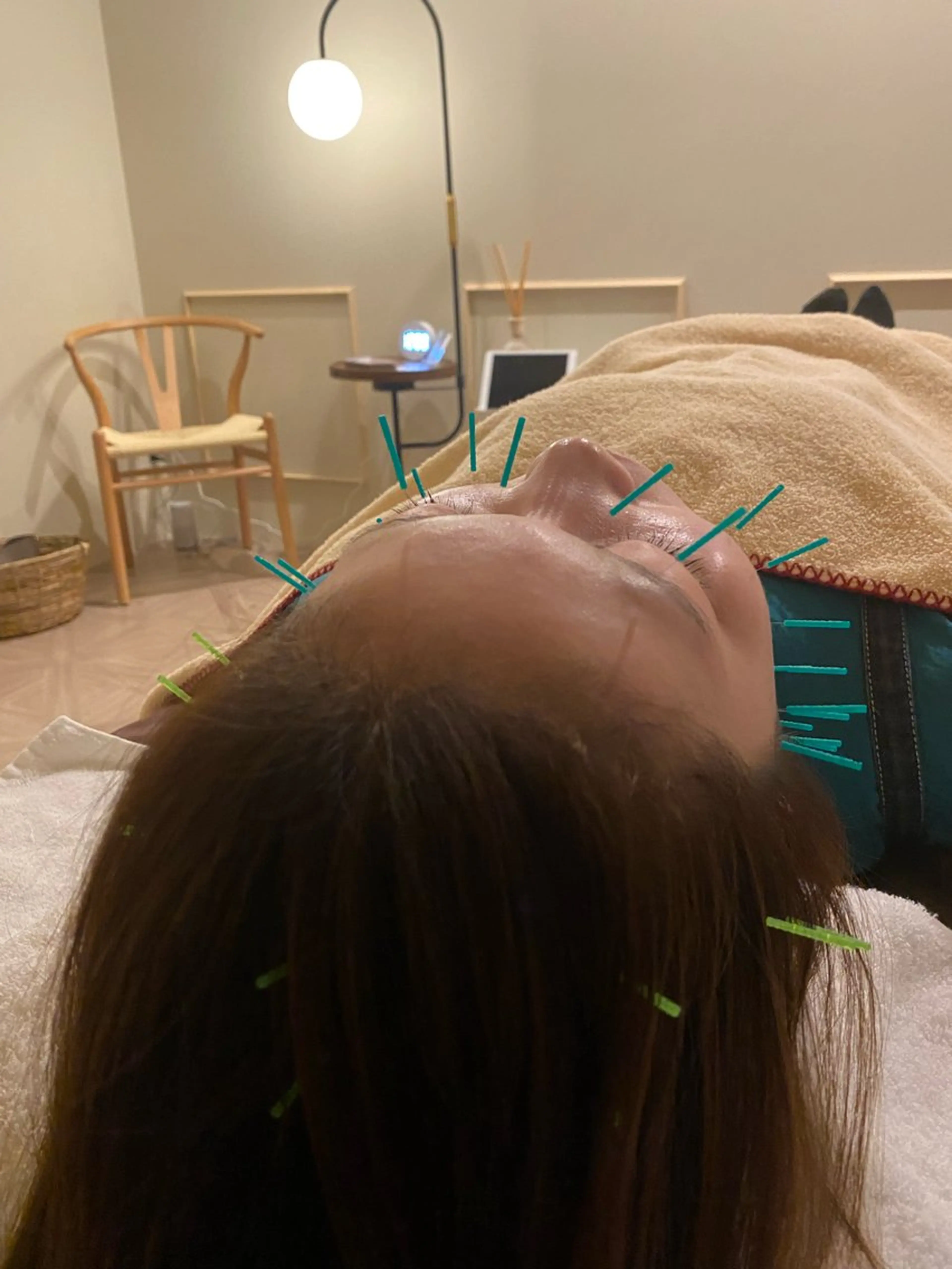 美容鍼/ヘッドスパ/ 💎さかもとのエステ・リラクイメージ