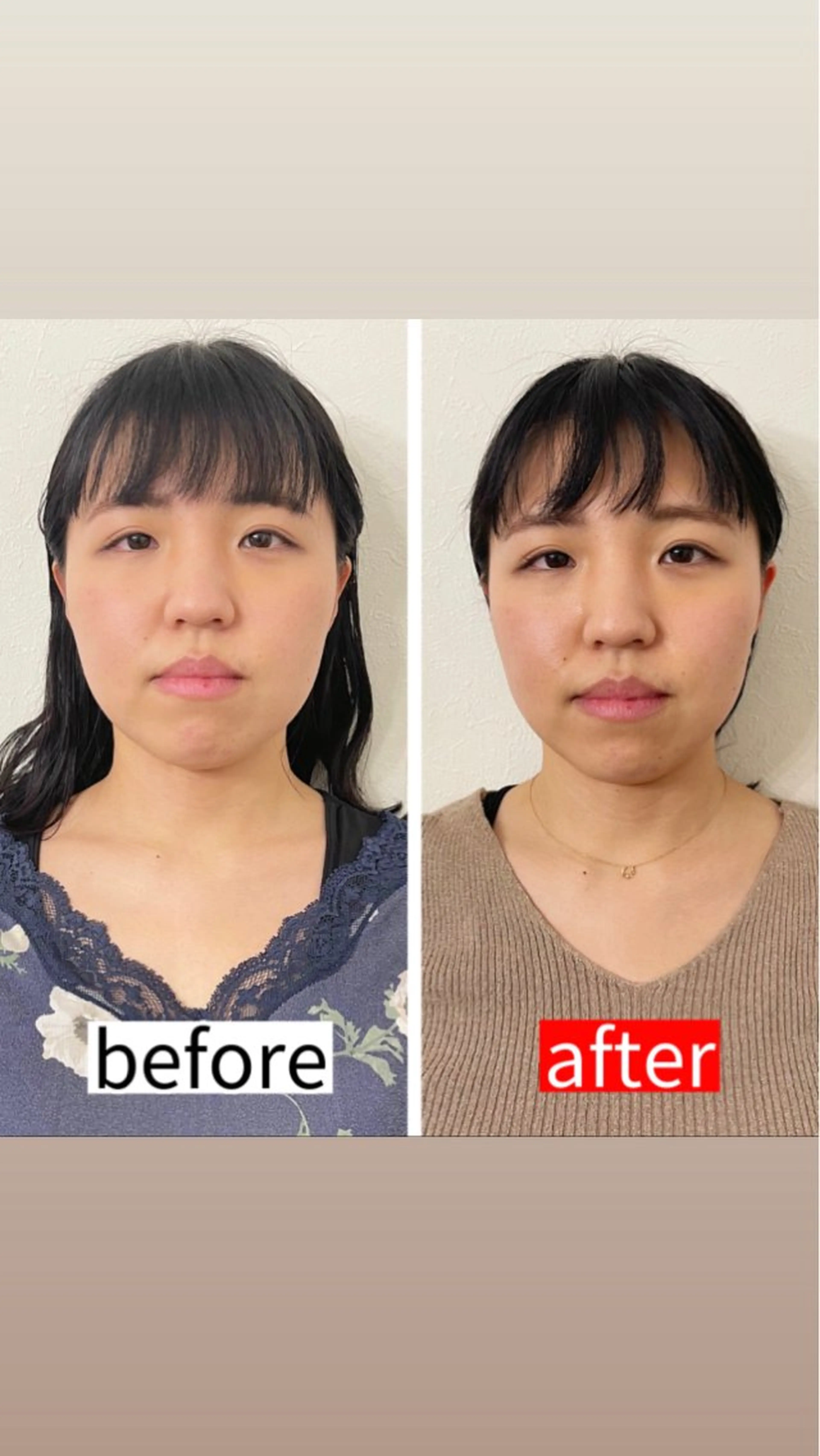 【5回券】小顔矯正+身体＋姿勢矯正フルセット60分《通常5回¥99,900》の写真