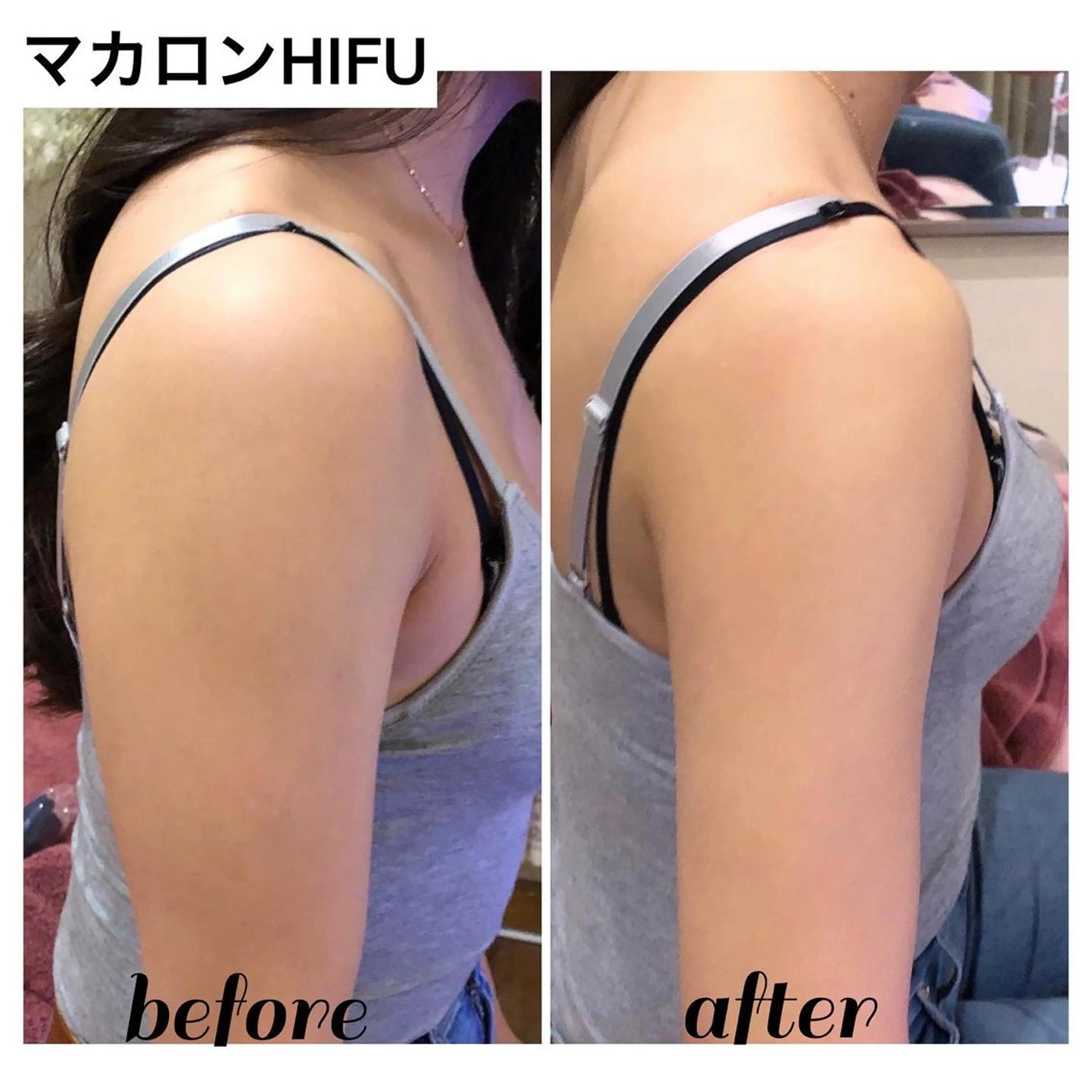 【ニキビ/肌管理】 salon varyのエステ・リラクイメージ