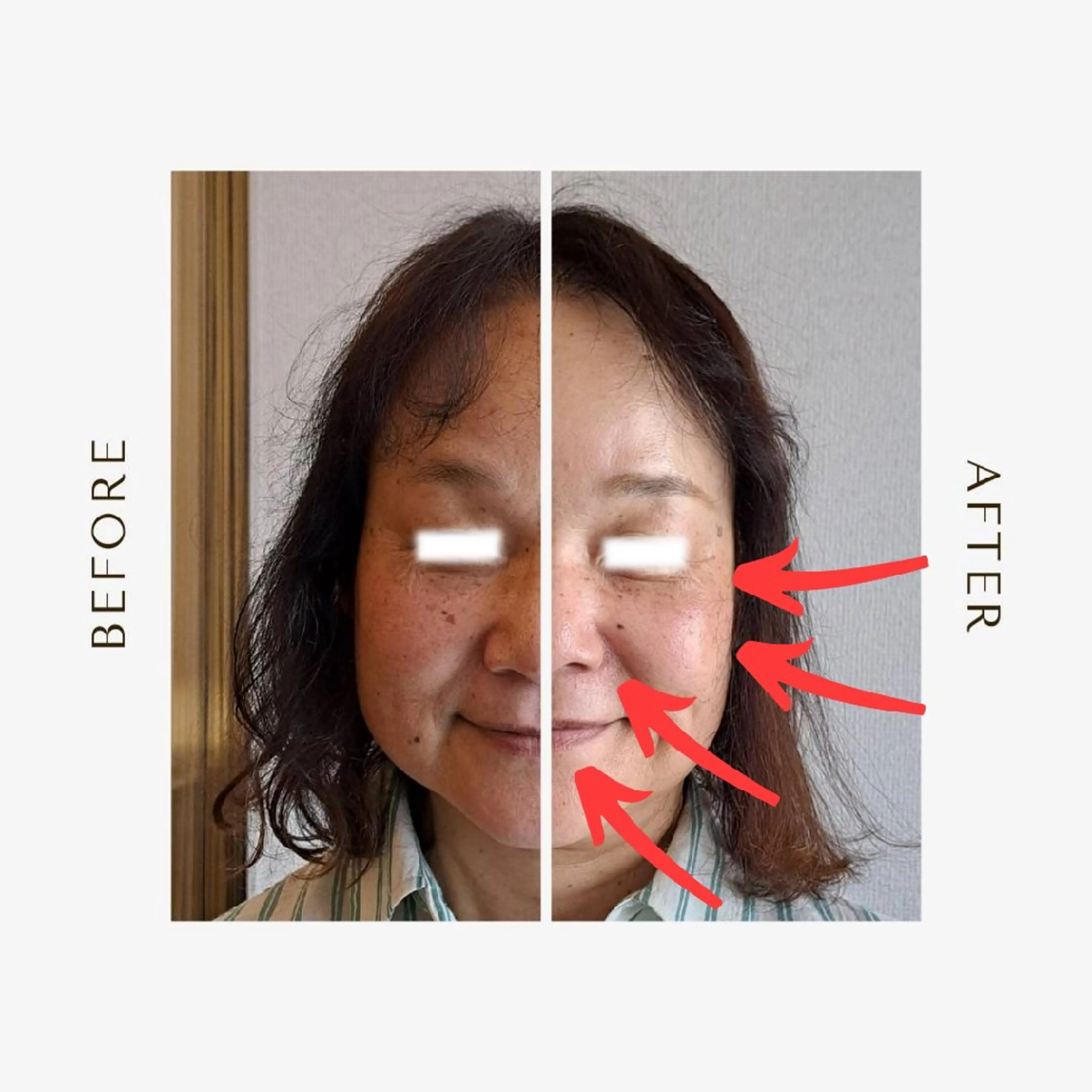 エステ リラク 鍼灸サロンmiyabi所属・美容鍼×エステ　鍼灸 サロンmiyabiのエステ・リラクイメージ