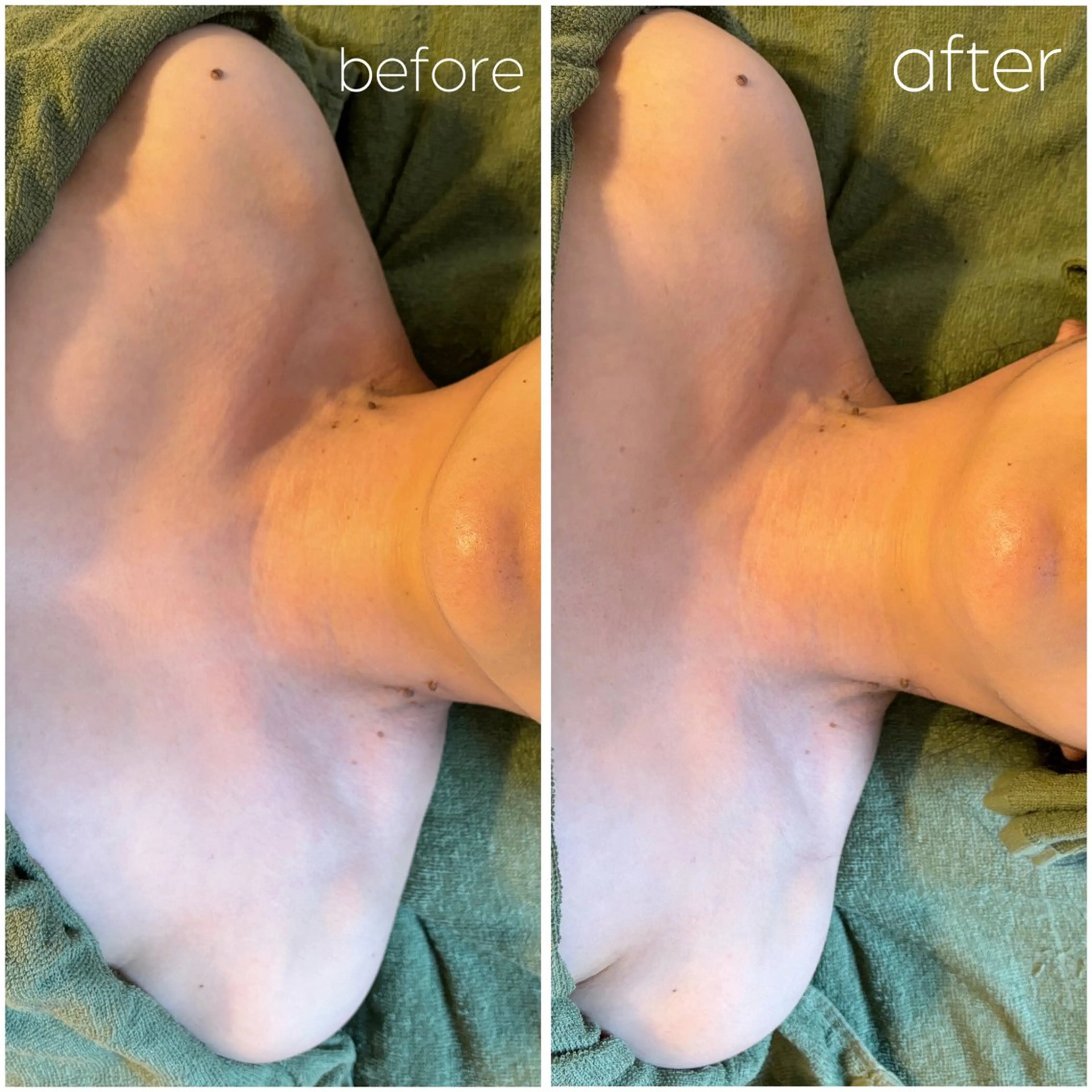 ドライヘッドスパ TOTONOESTのエステ・リラクイメージ