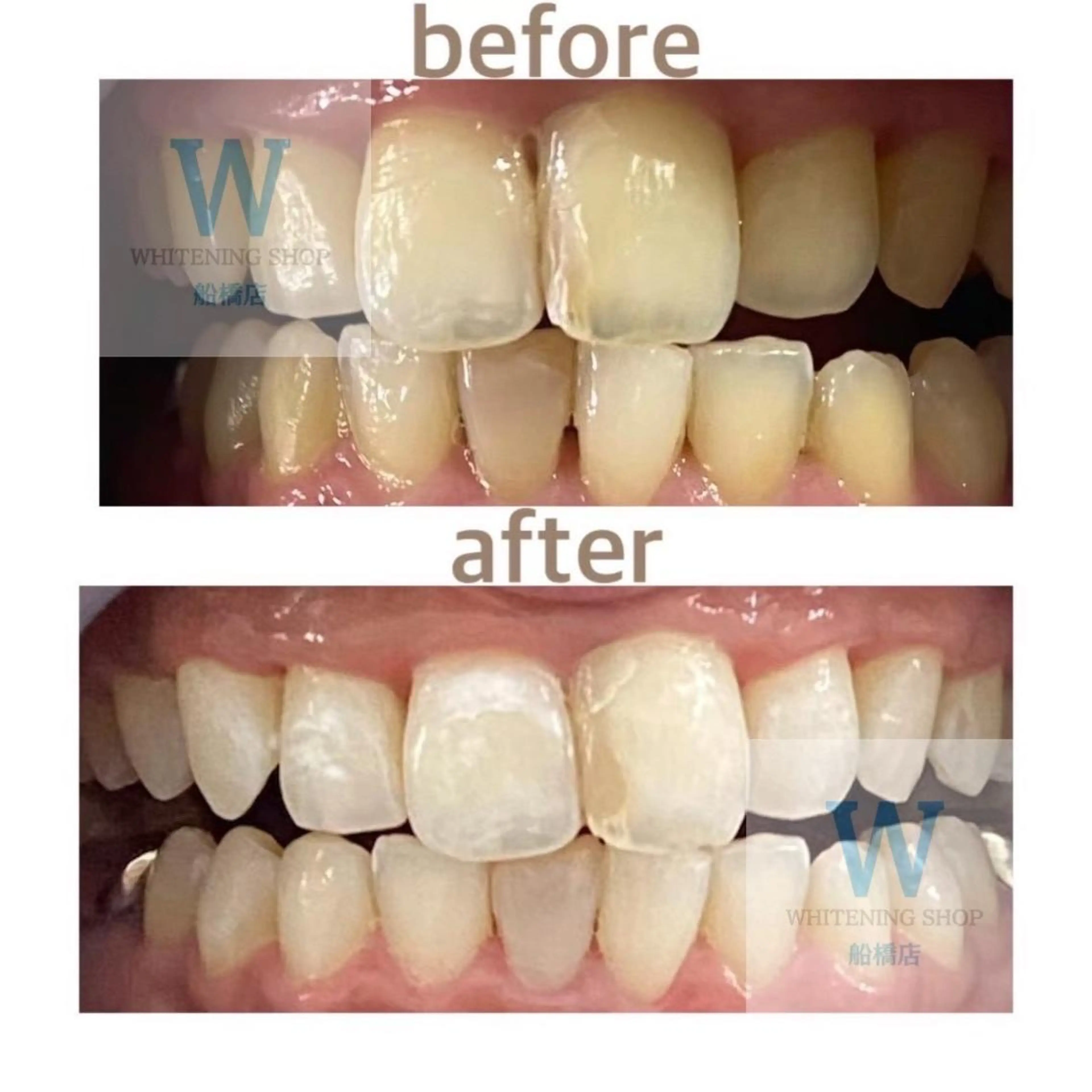 ホワイトニング ショップ船橋２号店のエステ・リラクイメージ