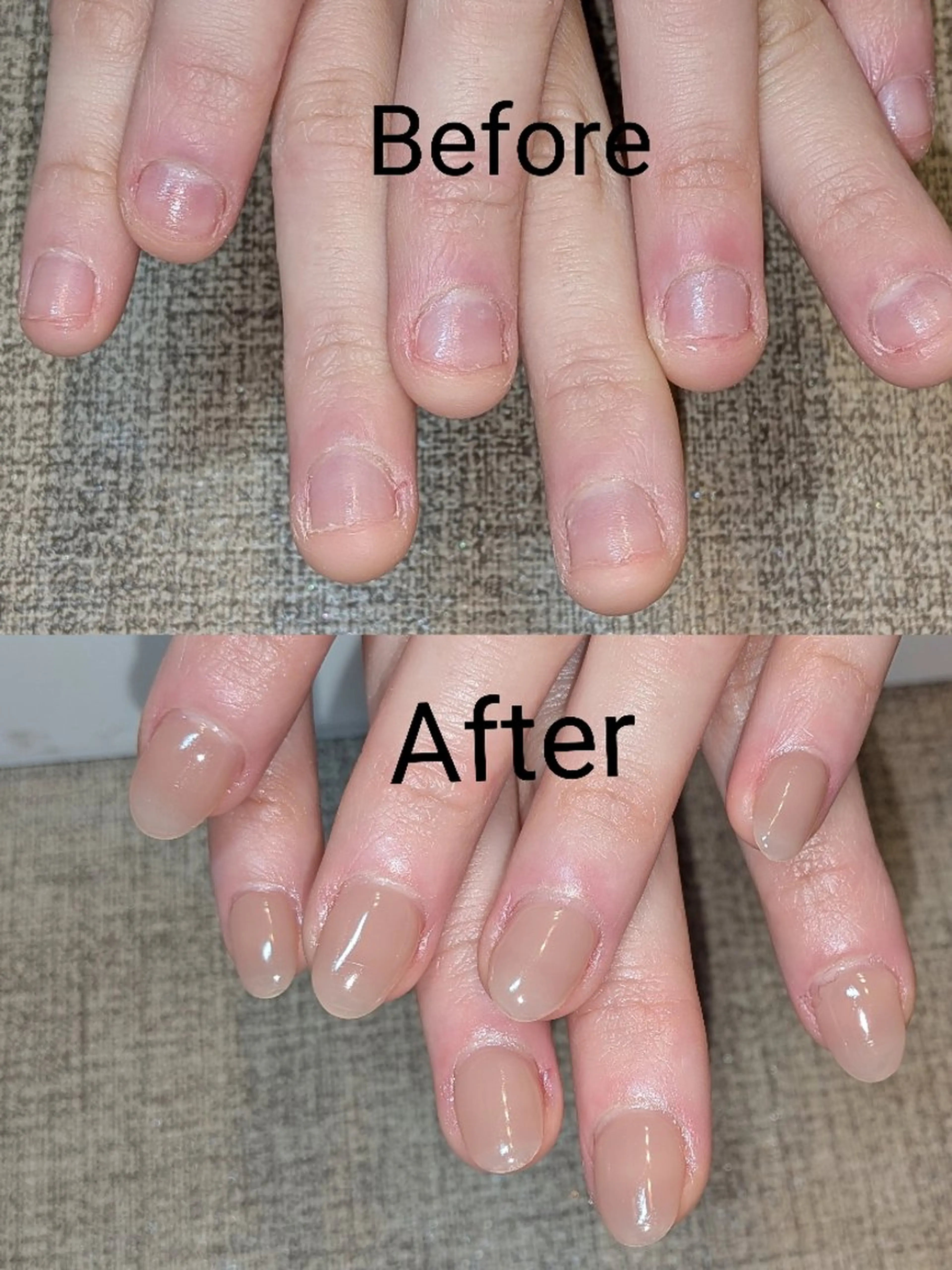 ネイル ハンドネイル ハンドケア ネイリストゆか💅 長さだし、深爪矯正のネイルデザイン