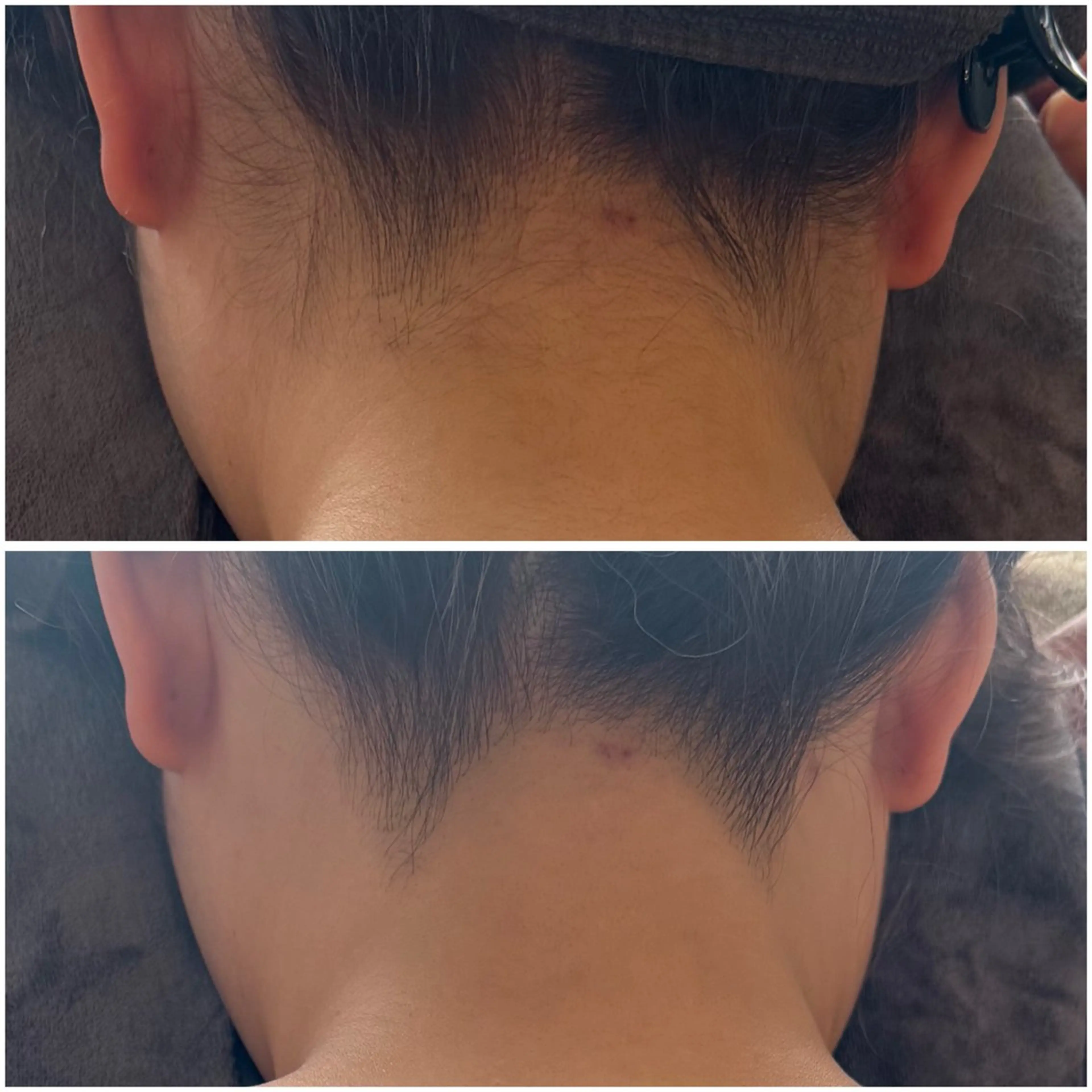 エステ snow flakeのエステ・リラクイメージ