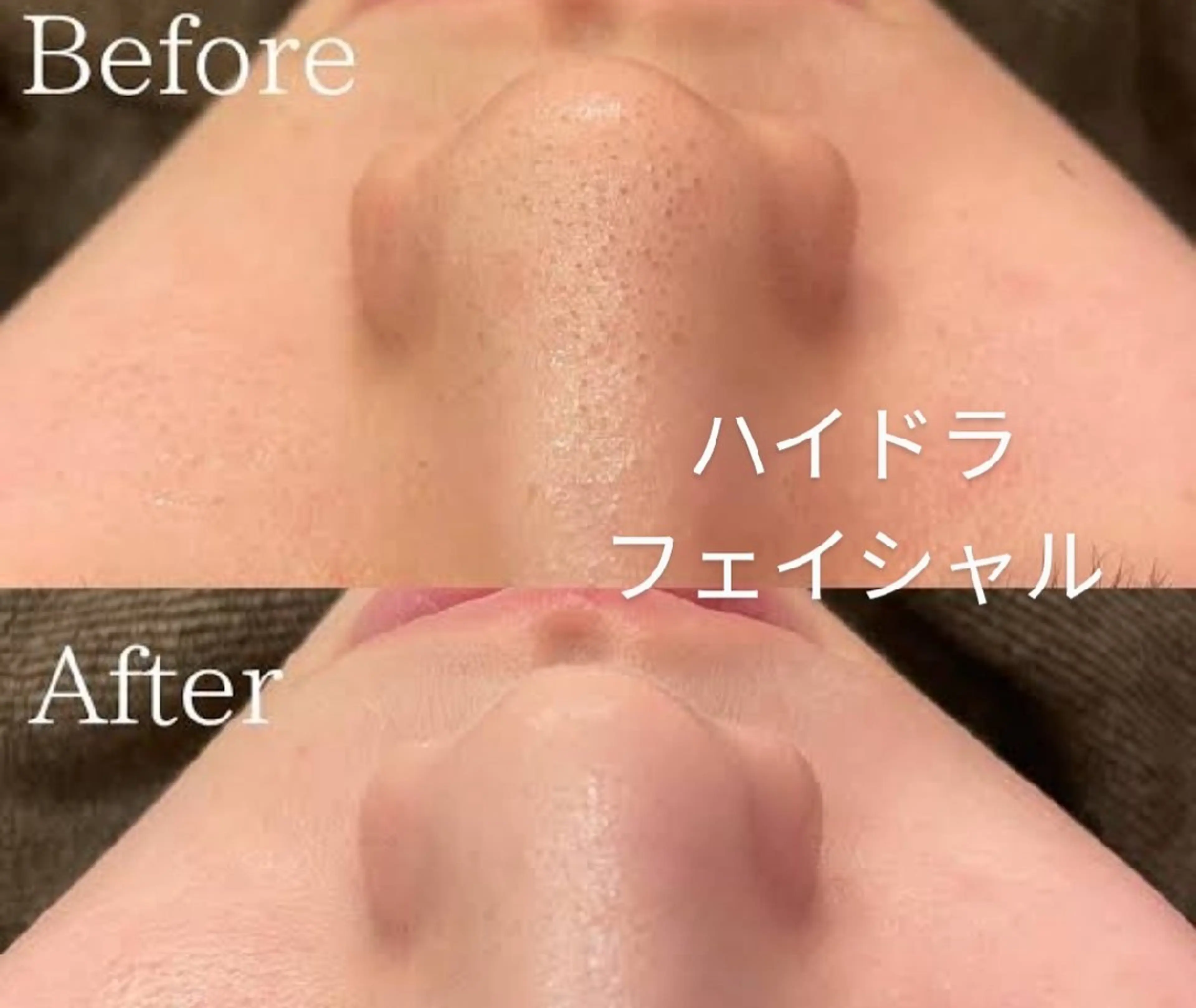 ハルモニア所属・エステハルモニア はるかのエステ・リラクイメージ