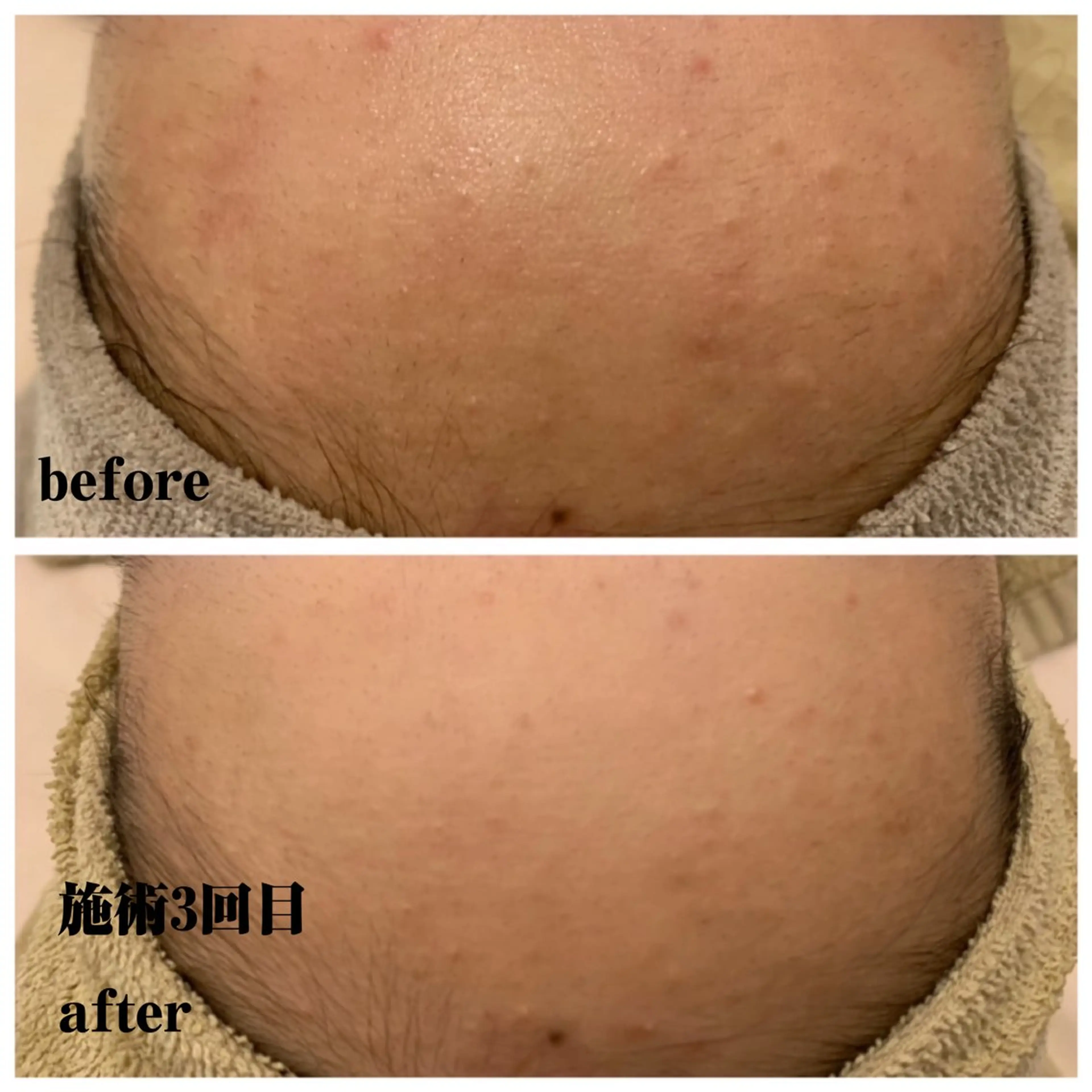 エステ LONO  by a little所属・LONO byalittleのエステ・リラクイメージ