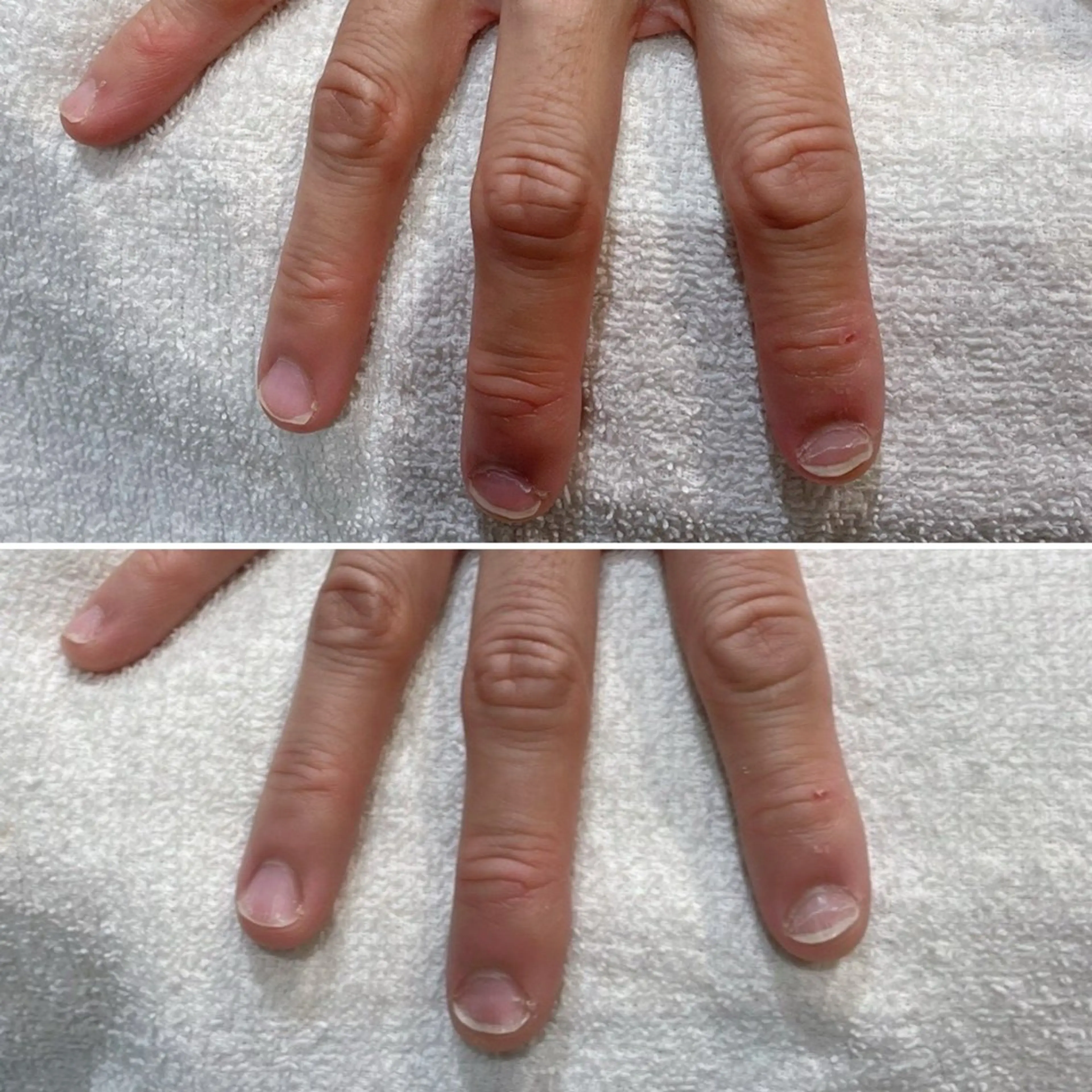 ネイル 痛くないシミ取り 【荻窪】石橋のヘアスタイル