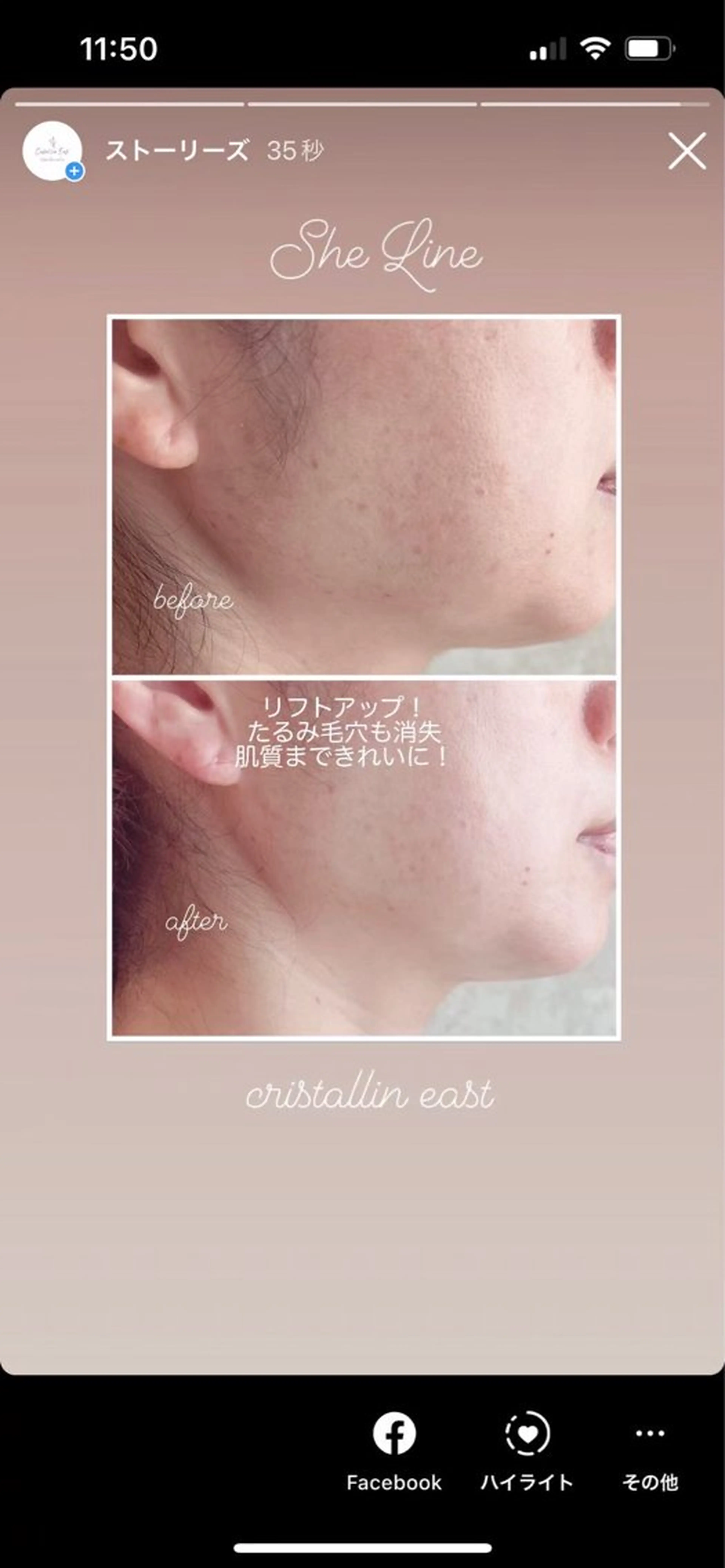 クリスタラン イーストのエステ・リラクイメージ