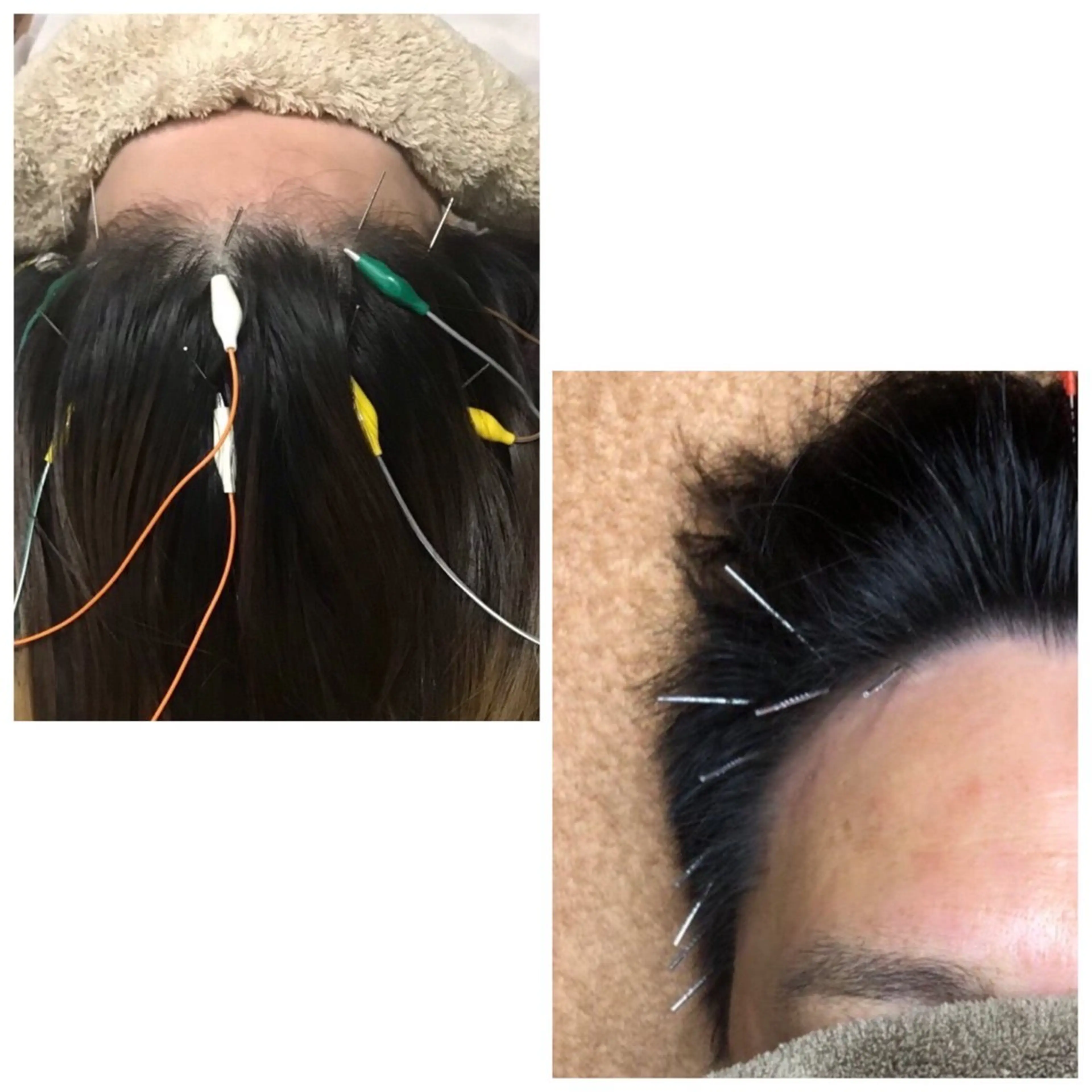 かすがい鍼灸院Re.heart所属・かすがい鍼灸院 Re.heartのエステ・リラクイメージ