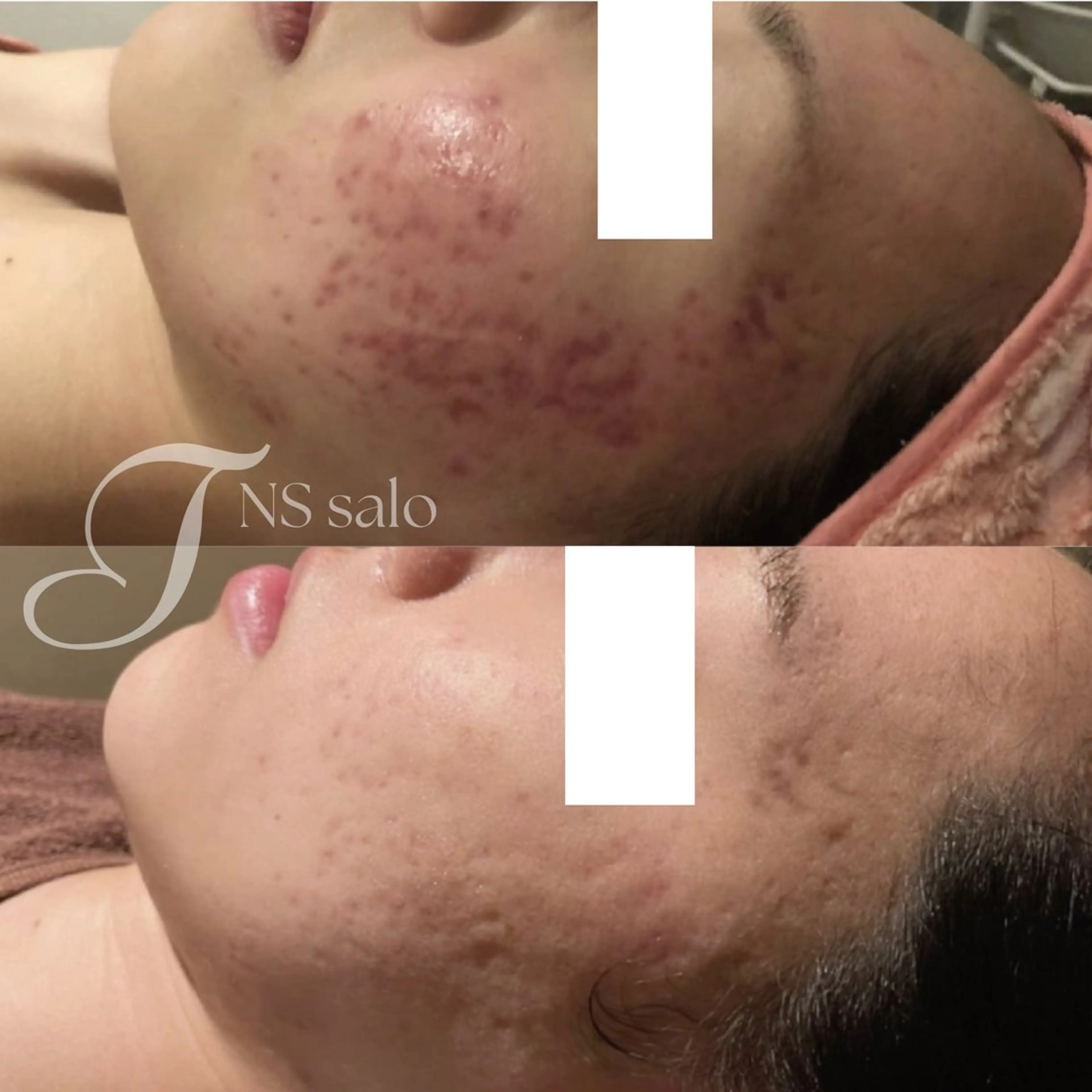 ナスサロ所属・💖韓国肌管理 :美容看護師/T🪽のエステ・リラクイメージ